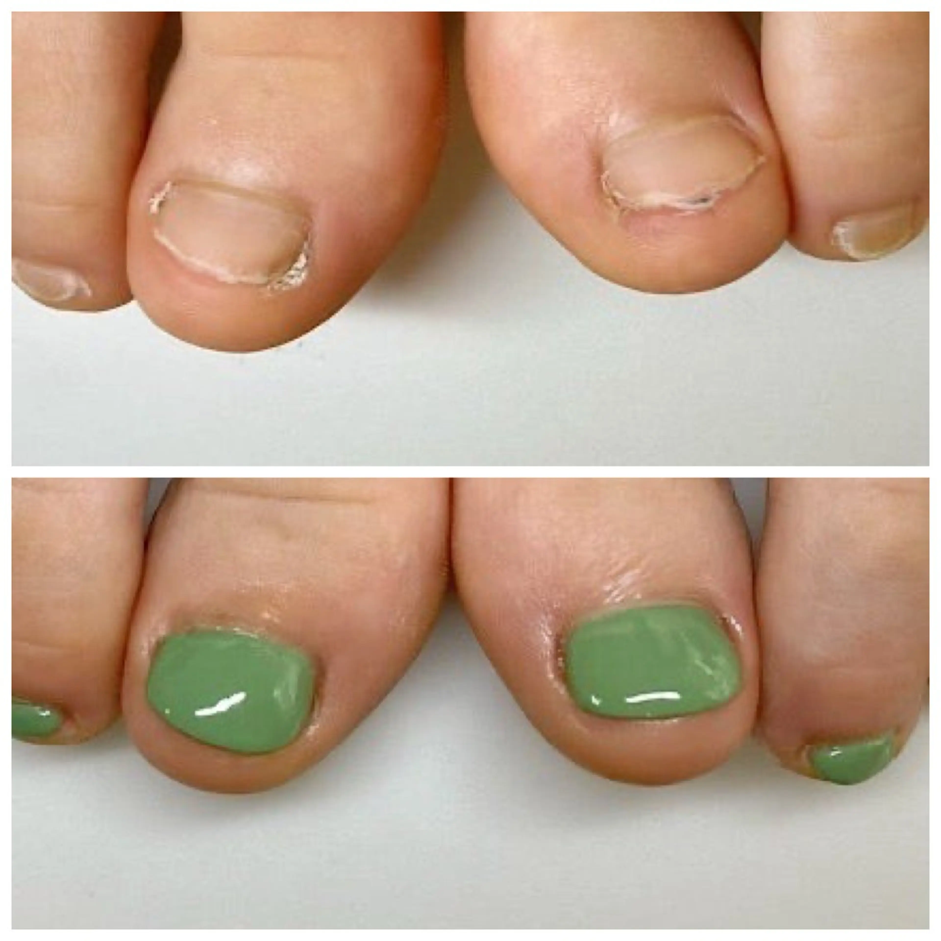 ネイル フットネイル ネイルサロンアリューム所属・ネイルサロン アリュームのネイルデザイン