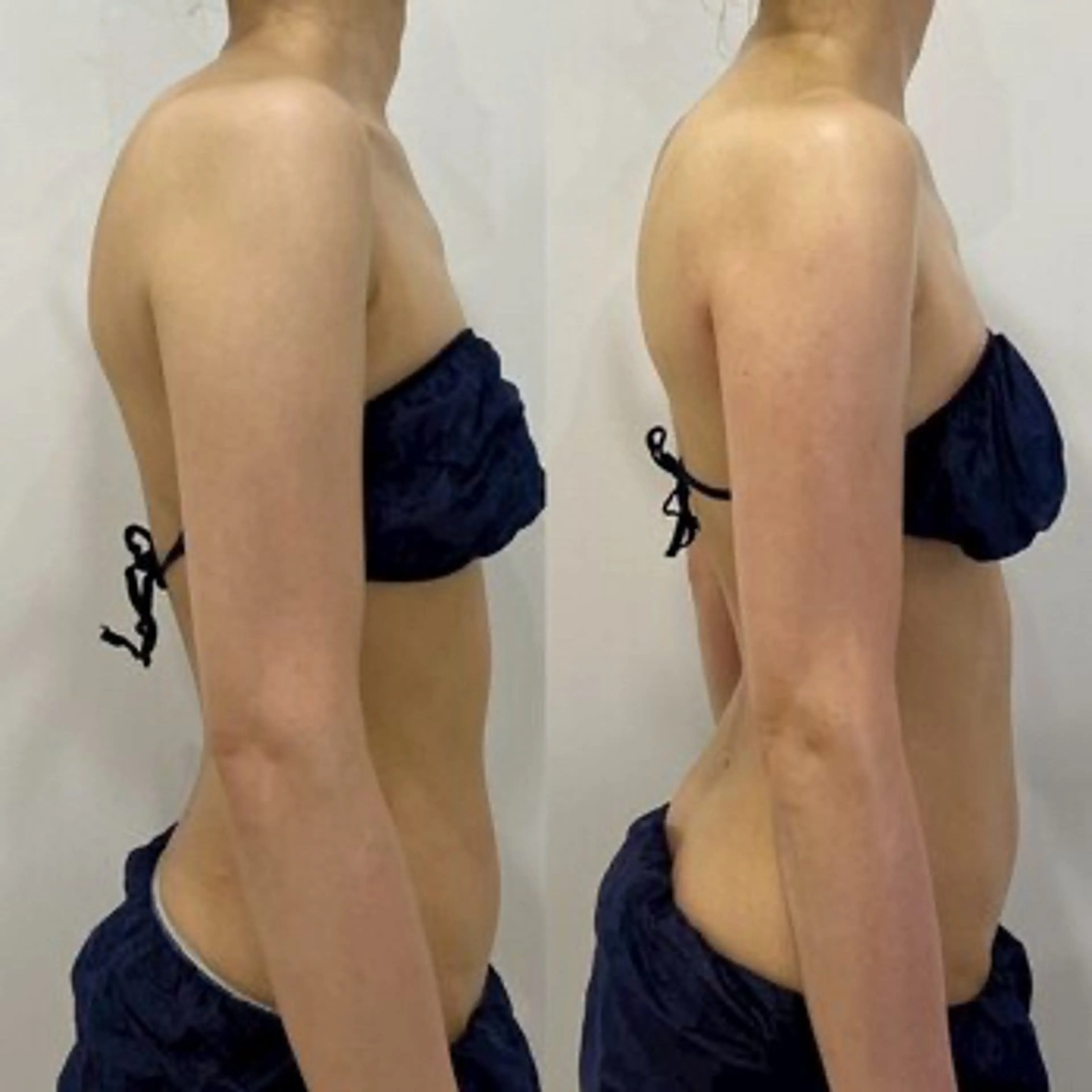 ブライダル痩身×脱毛 尼崎駅前サロンのエステ・リラクイメージ