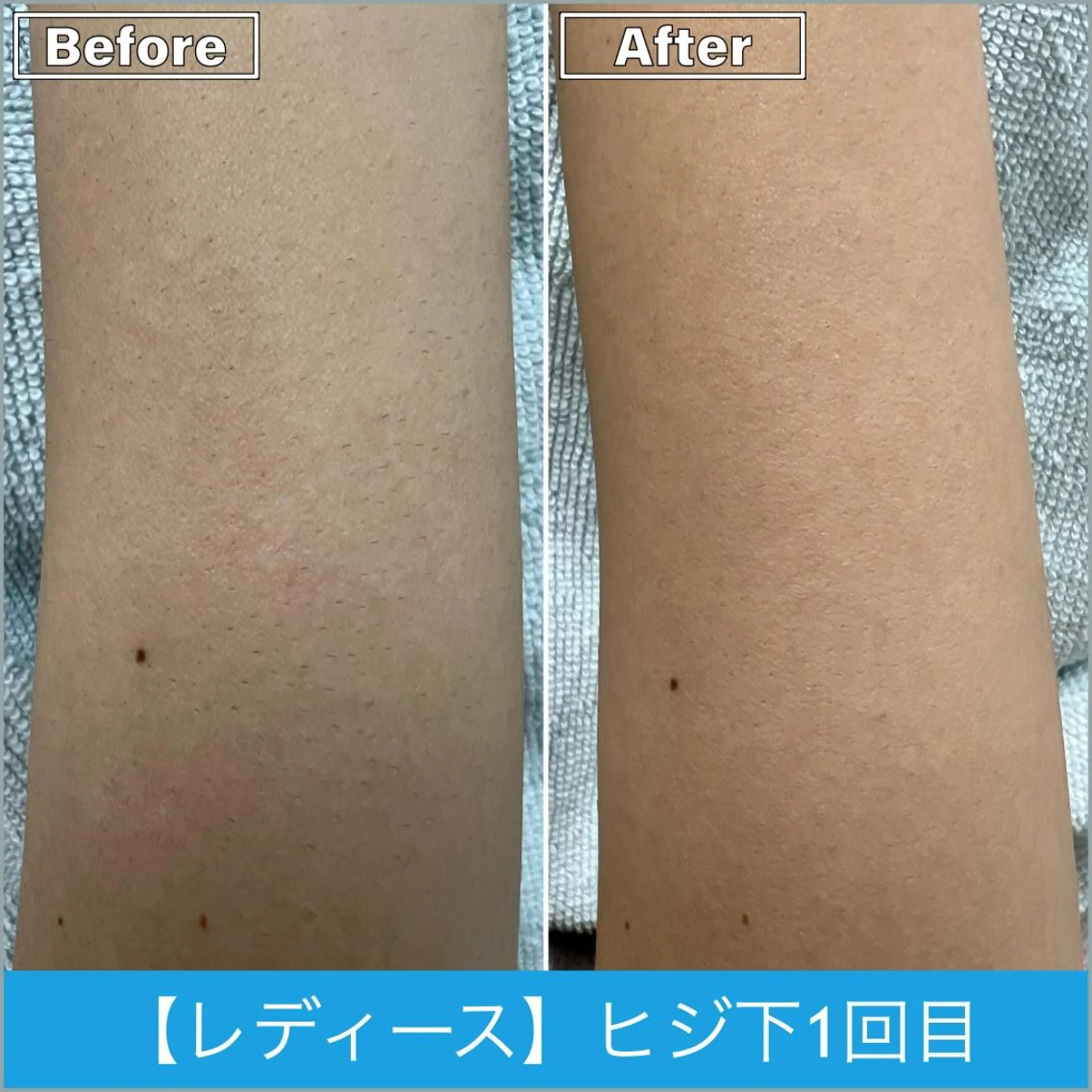 脱毛 プライベートサロン シャルムのその他イメージ