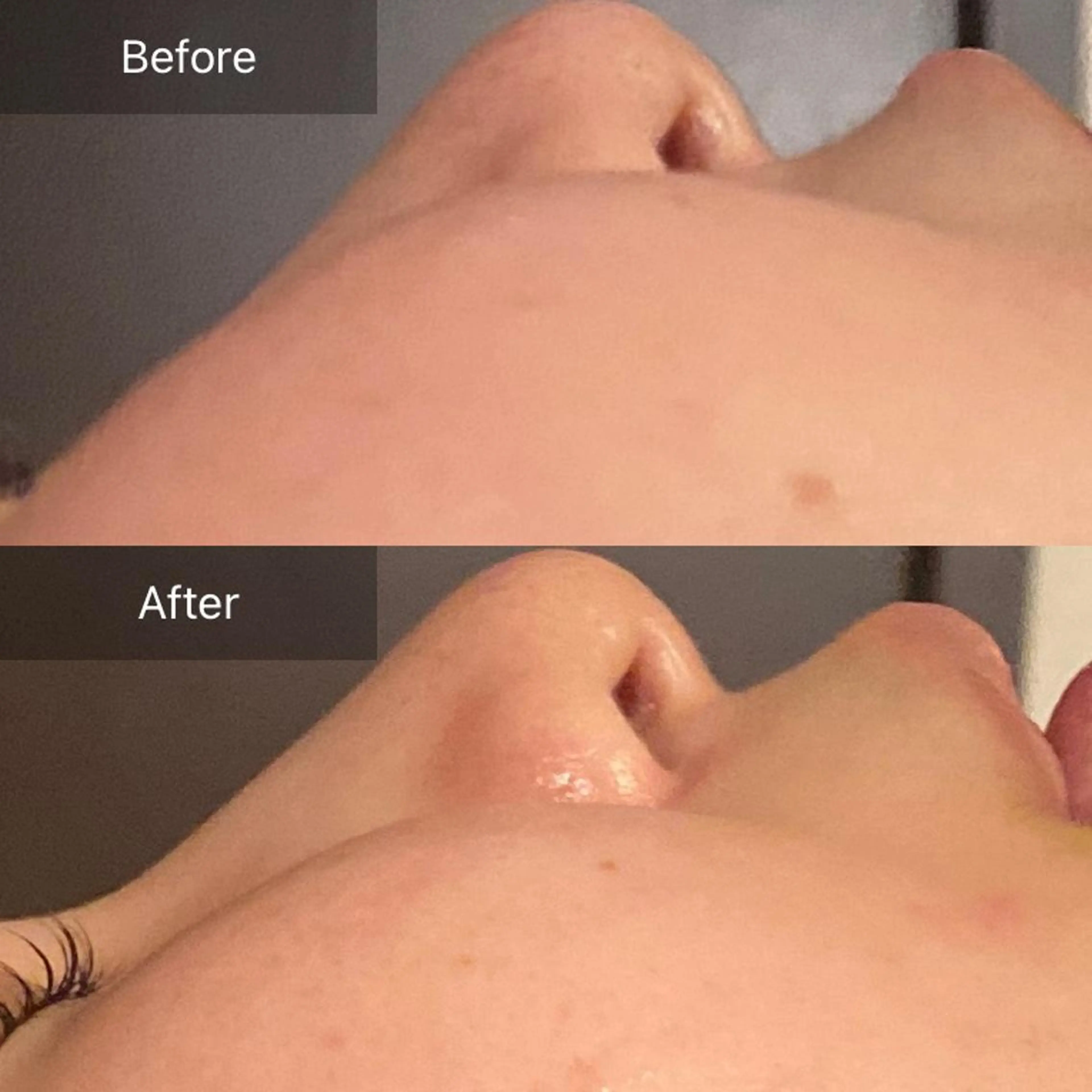 Mandarin Orange所属・毛穴から始める肌メン テマンダリンオレンジのエステ・リラクイメージ