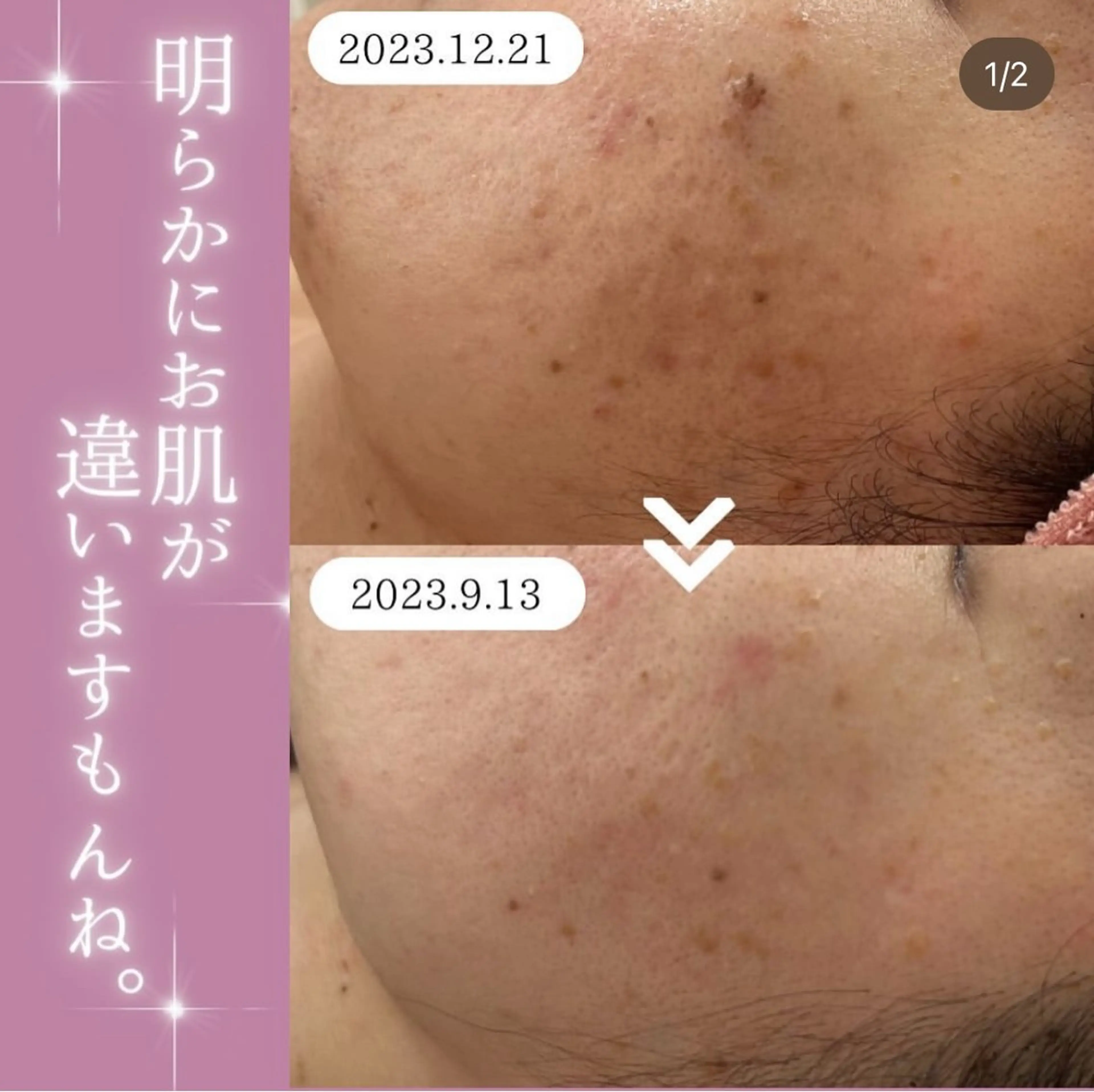 【現役看護師】高来 笑子のエステ・リラクイメージ