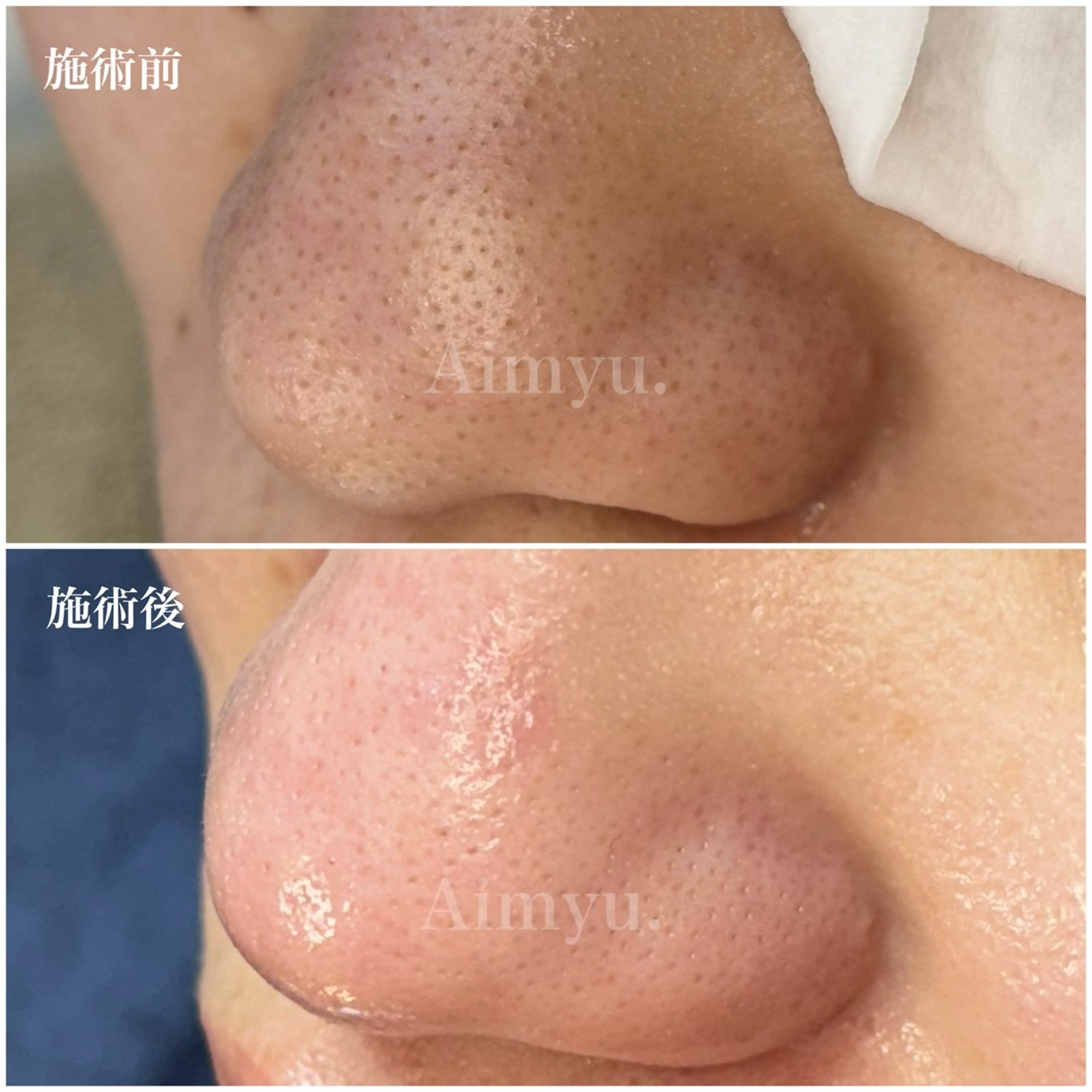 毛穴専門店アイミュー mamiのエステ・リラクイメージ