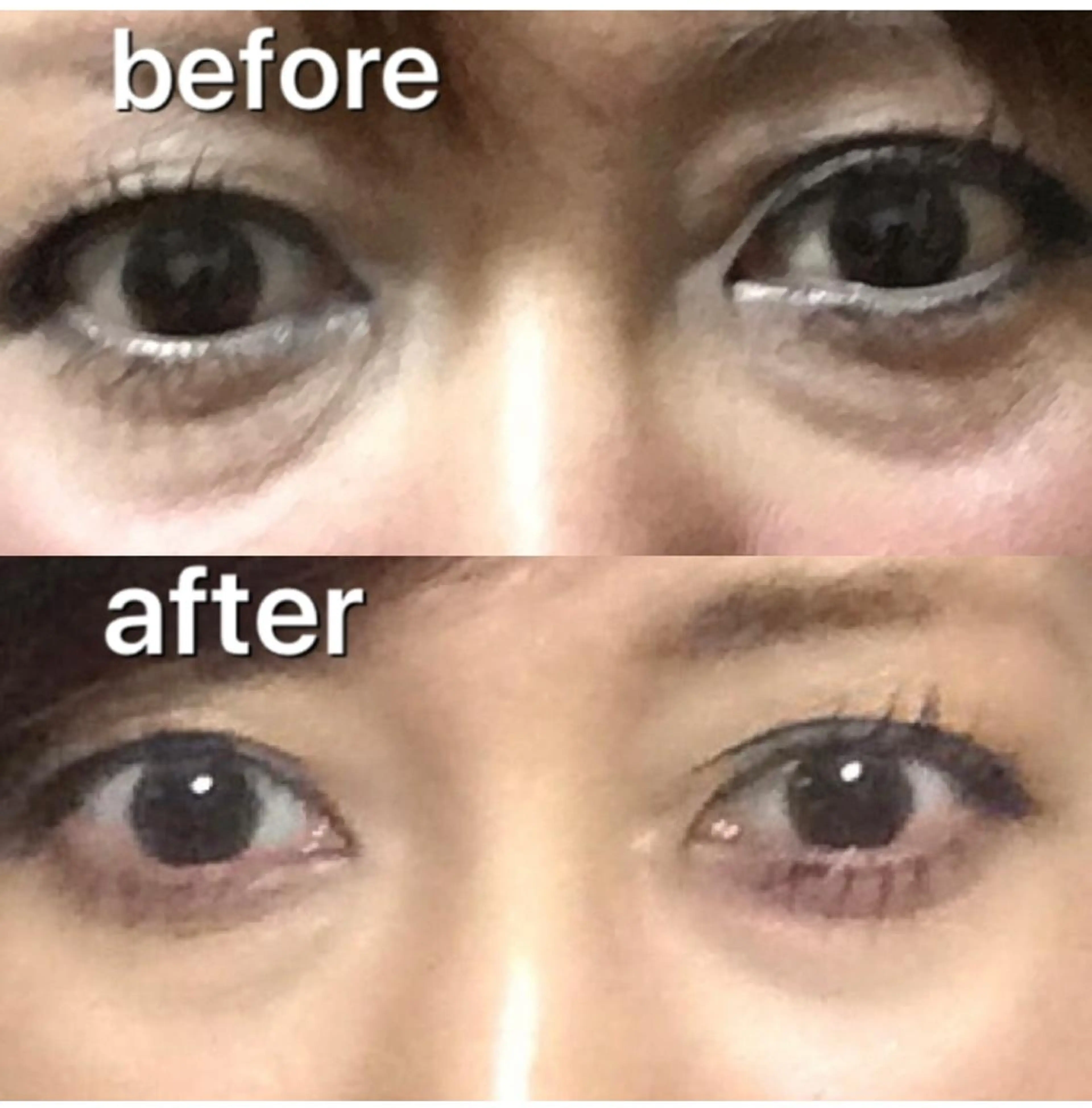 エステ 小野 優子の眉毛・アイブロウイメージ