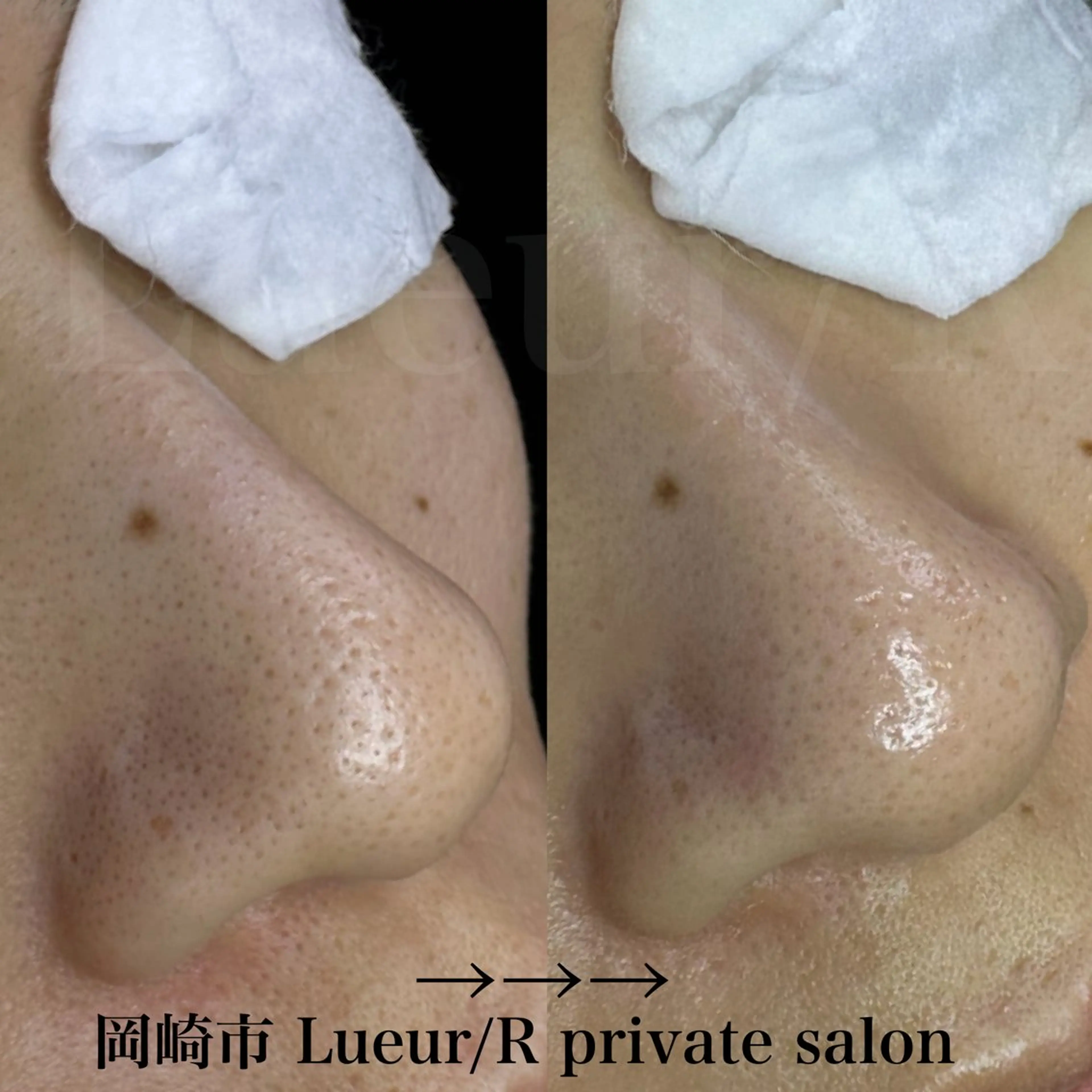 エステ 大久保 里奈のエステ・リラクイメージ