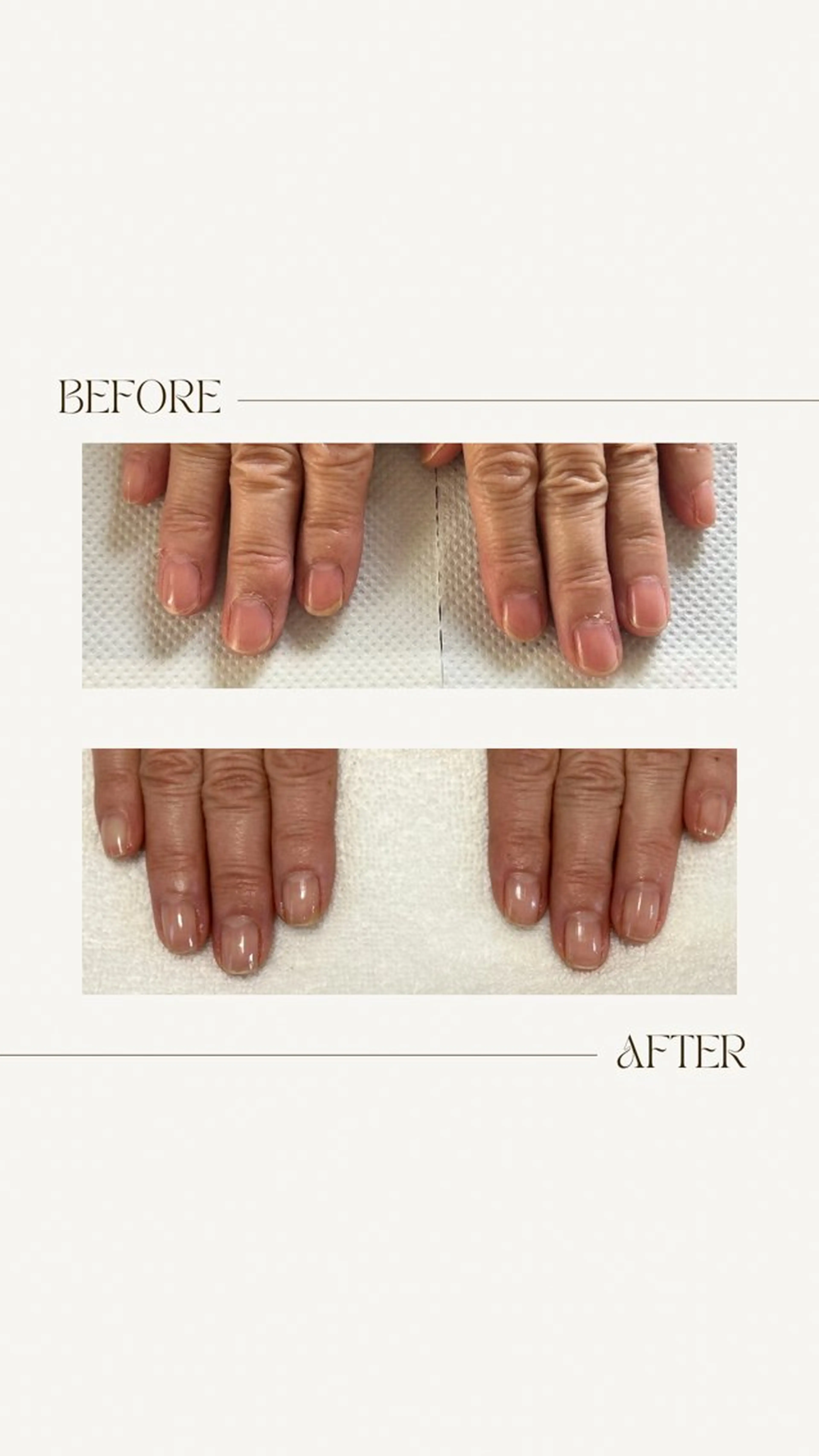 ネイル ハンドネイル ハンドケア fote-自爪育成 ネイルケアサロン-のネイルデザイン