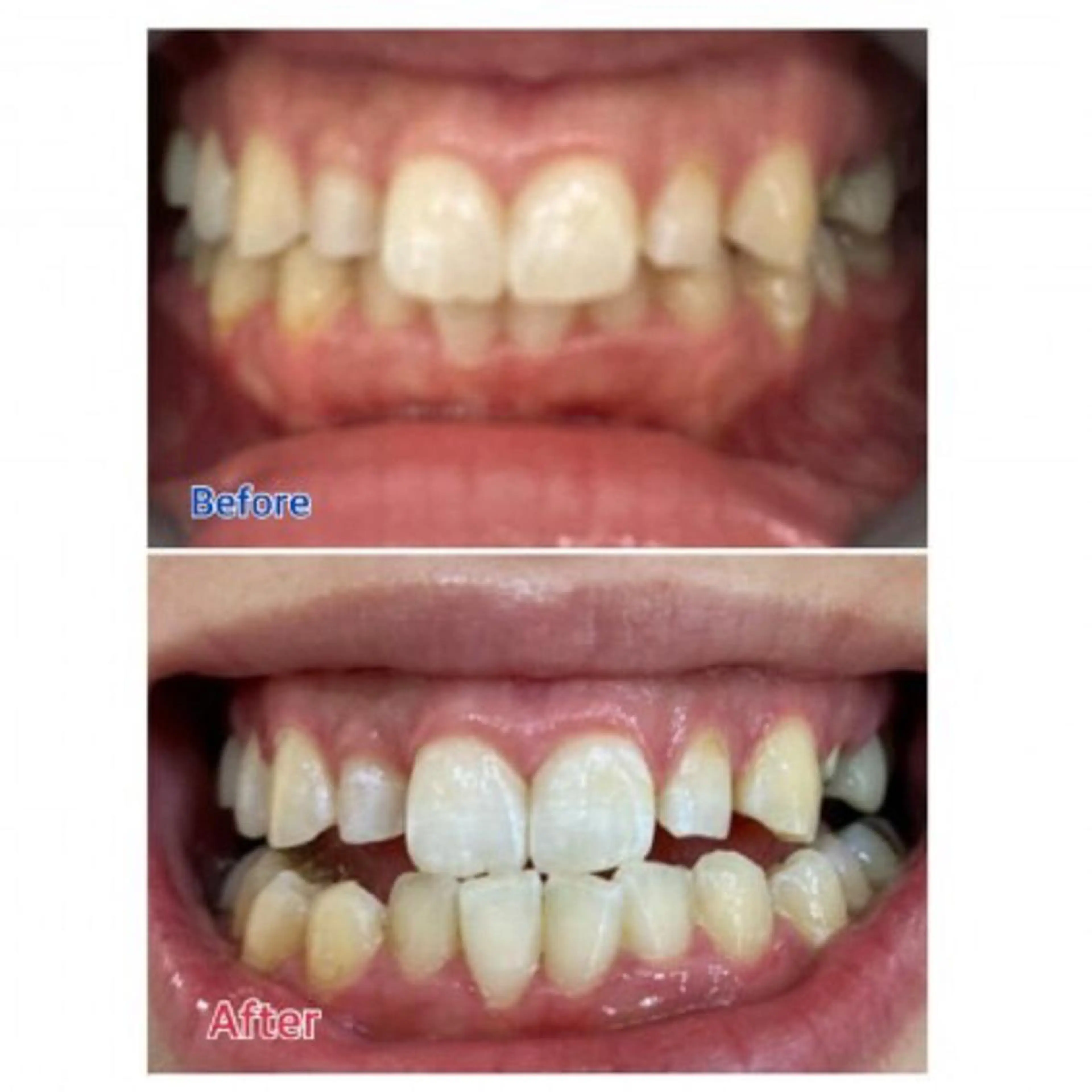 Ｍ渋谷 ホワイトニングのエステ・リラクイメージ