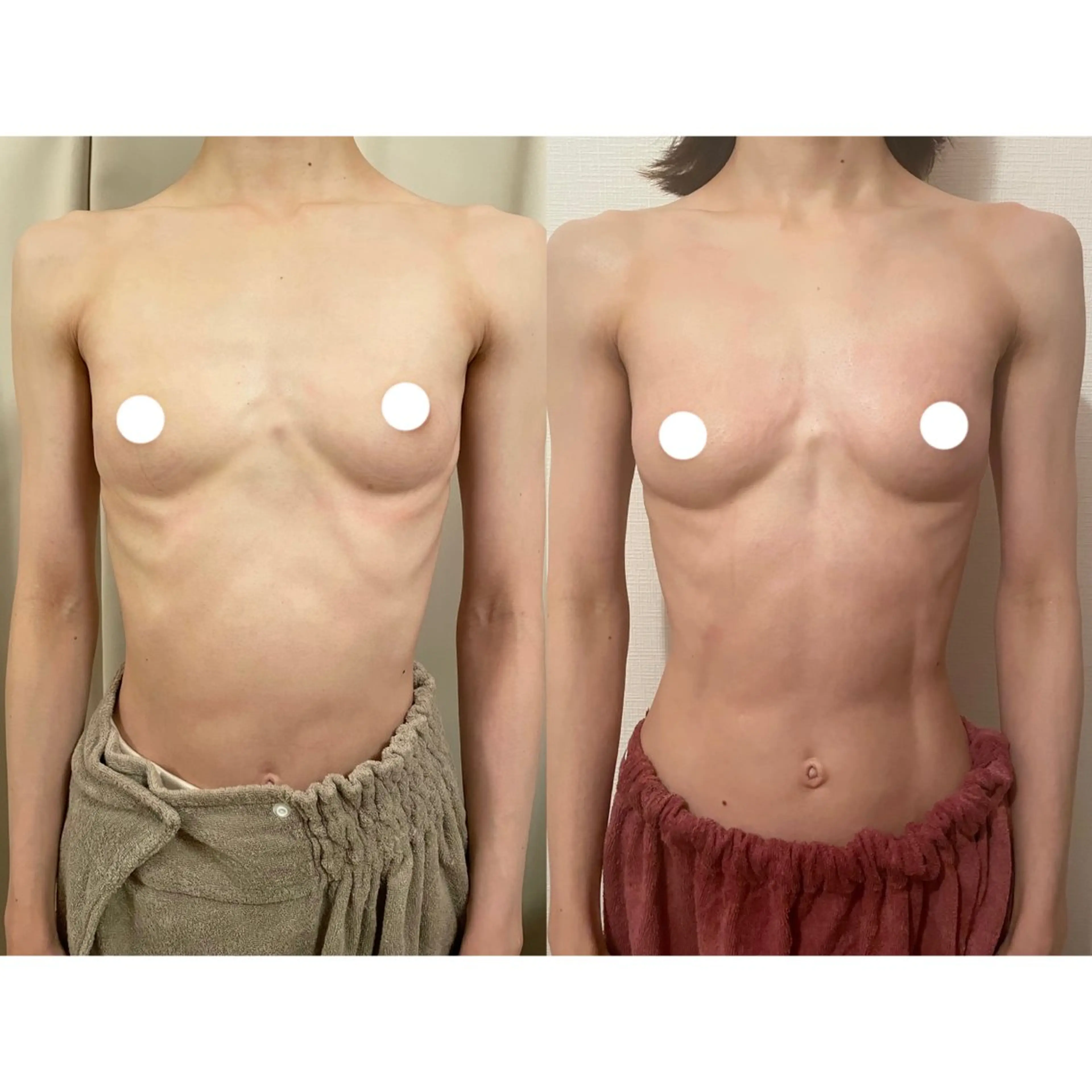 エステ ポテンツァ&針美容 バストアップ専門店のエステ・リラクイメージ