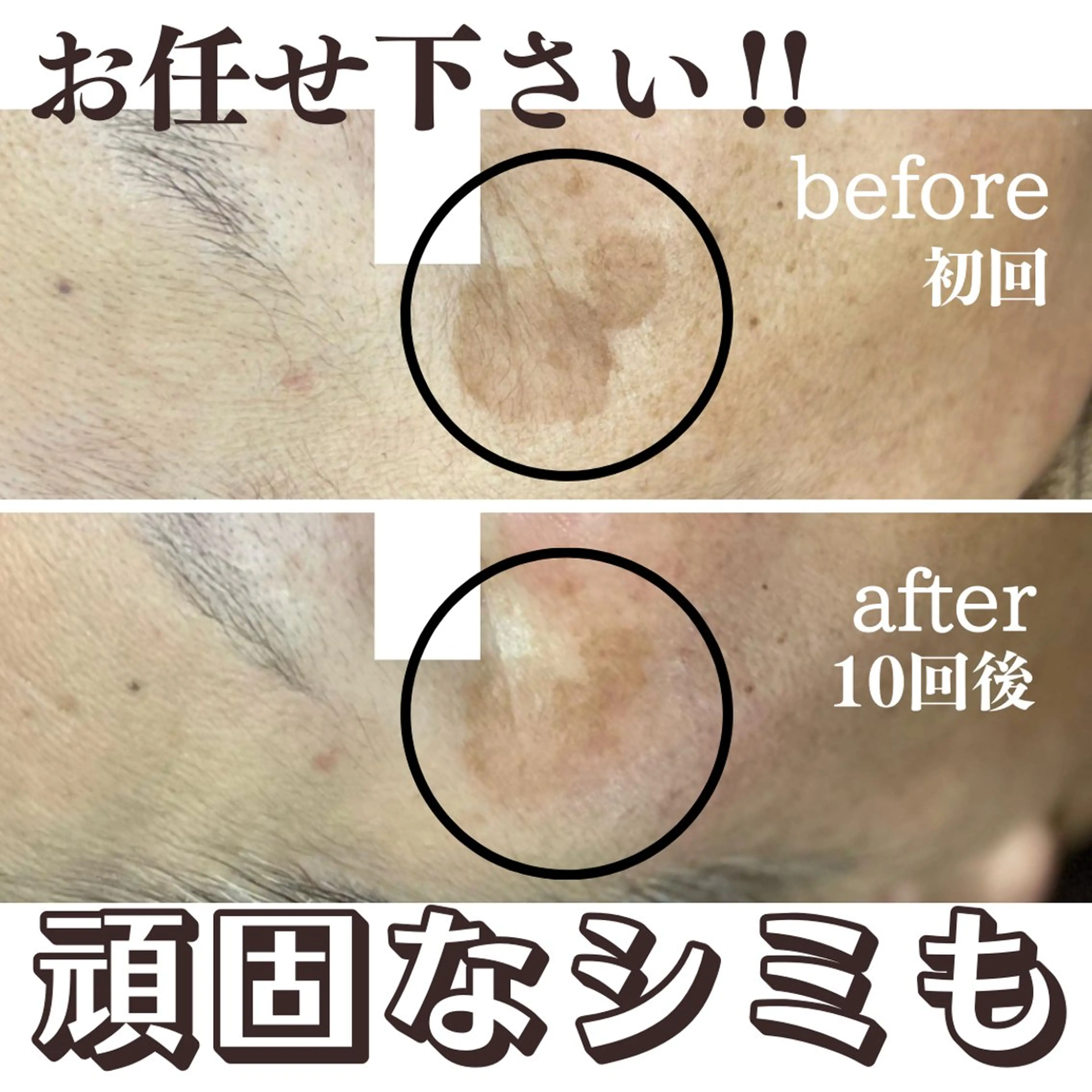 エステ 最新シミケアLily de pearlのエステ・リラクイメージ