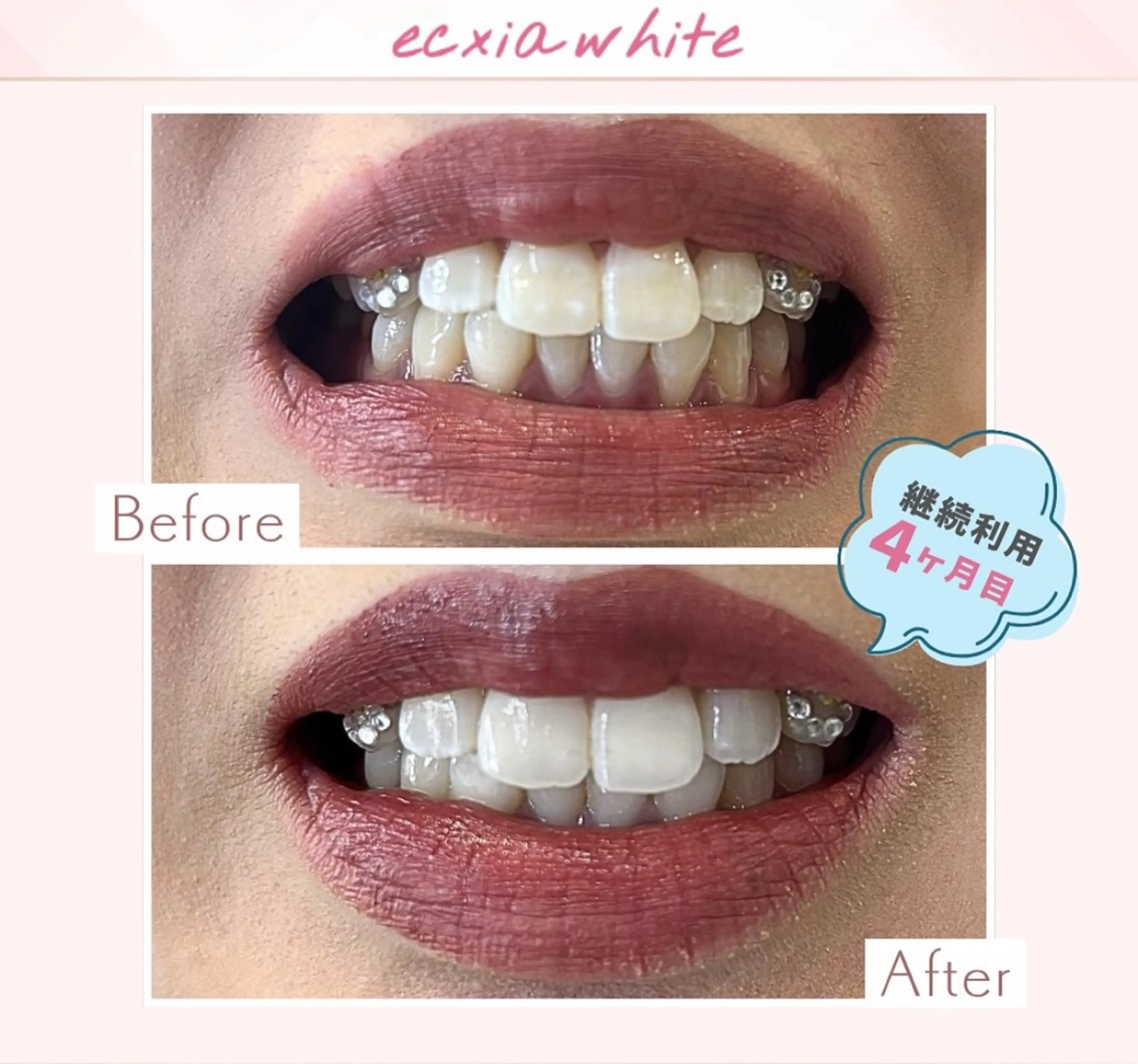 yumi❤︎ ホワイトニングのその他イメージ