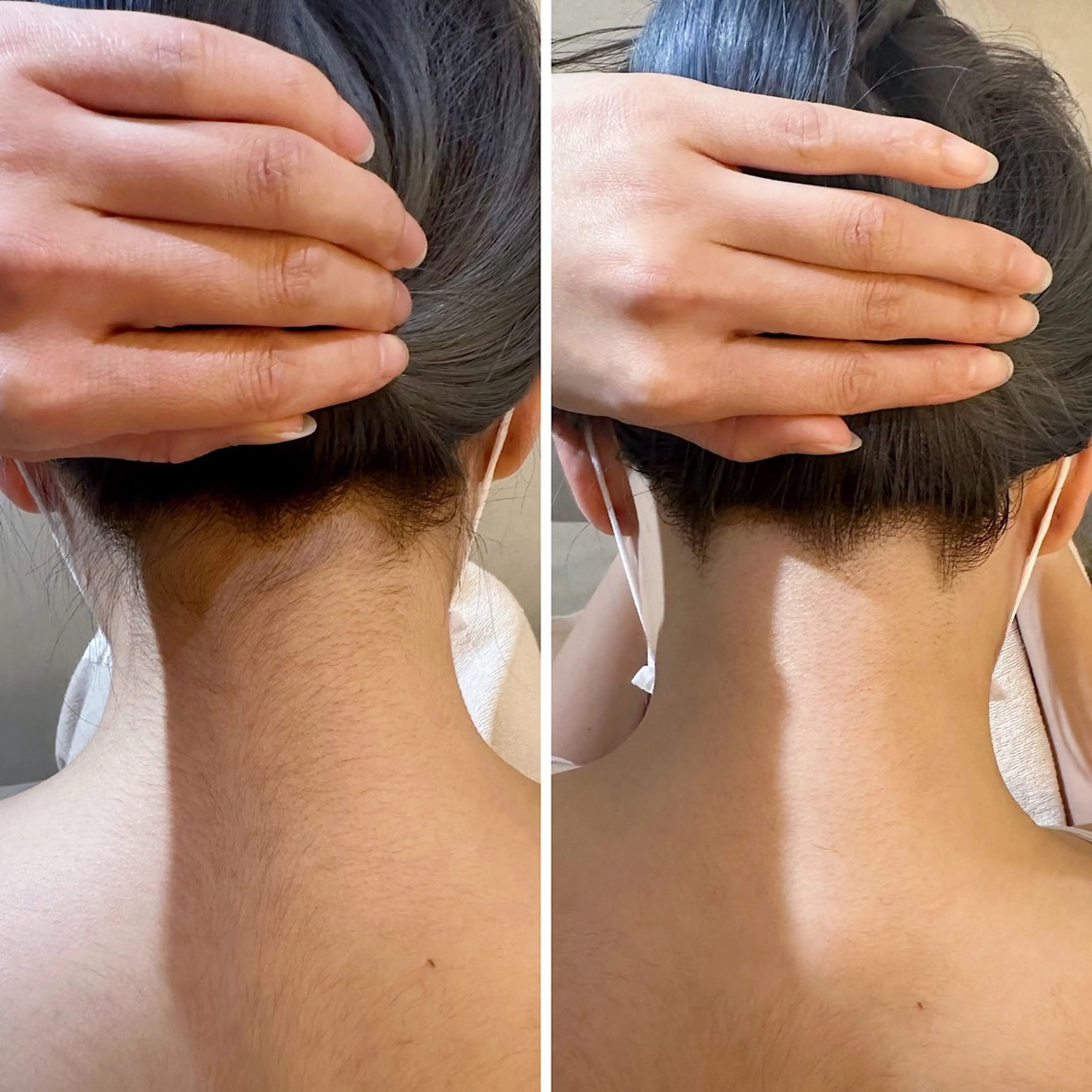 脱毛 うなじ脱毛/美肌脱毛 LABELのエステ・リラクイメージ