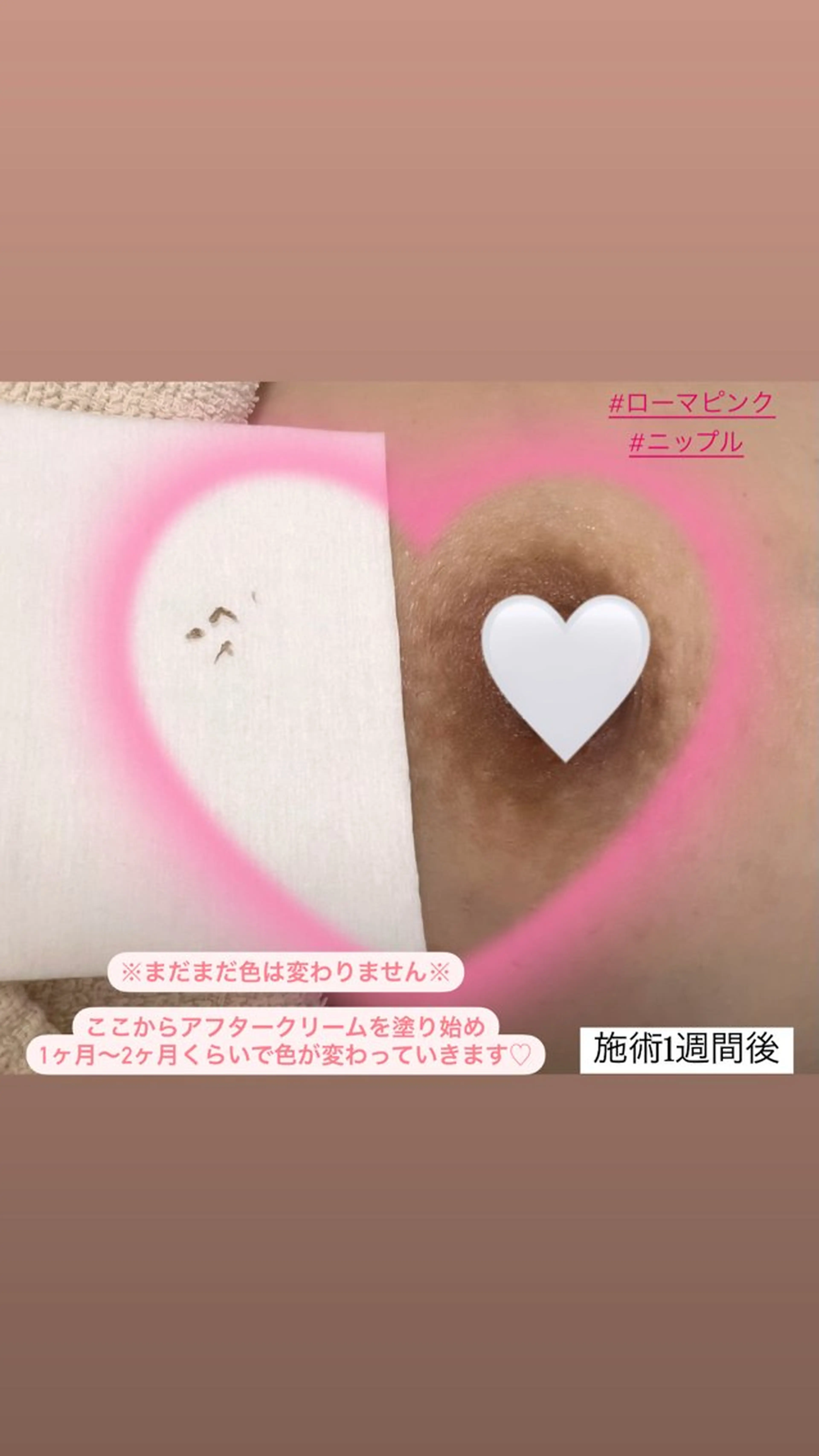 Raviy 【痩身専門・肌管理】のエステ・リラクイメージ