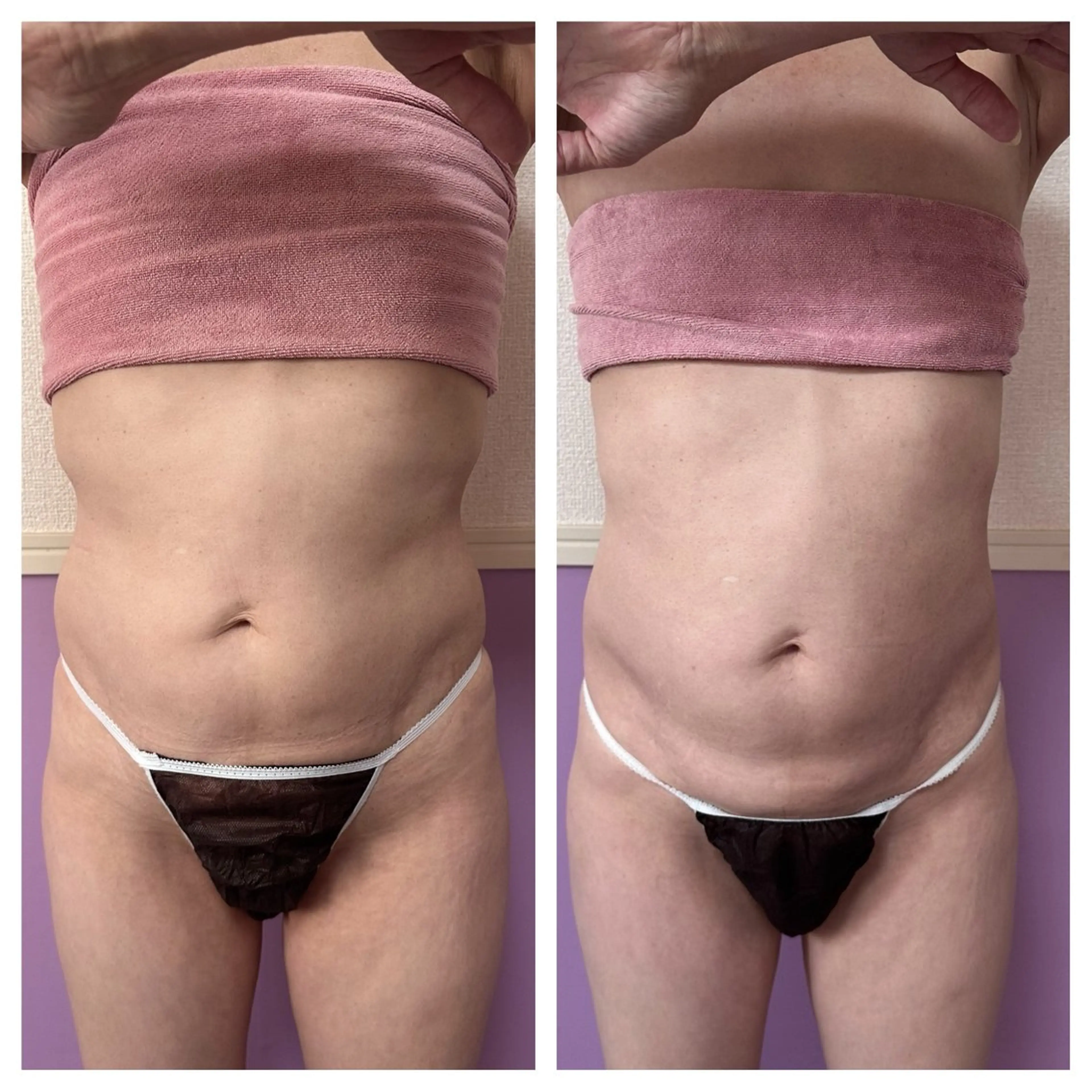 エステ バストアップサロン Mielのエステ・リラクイメージ