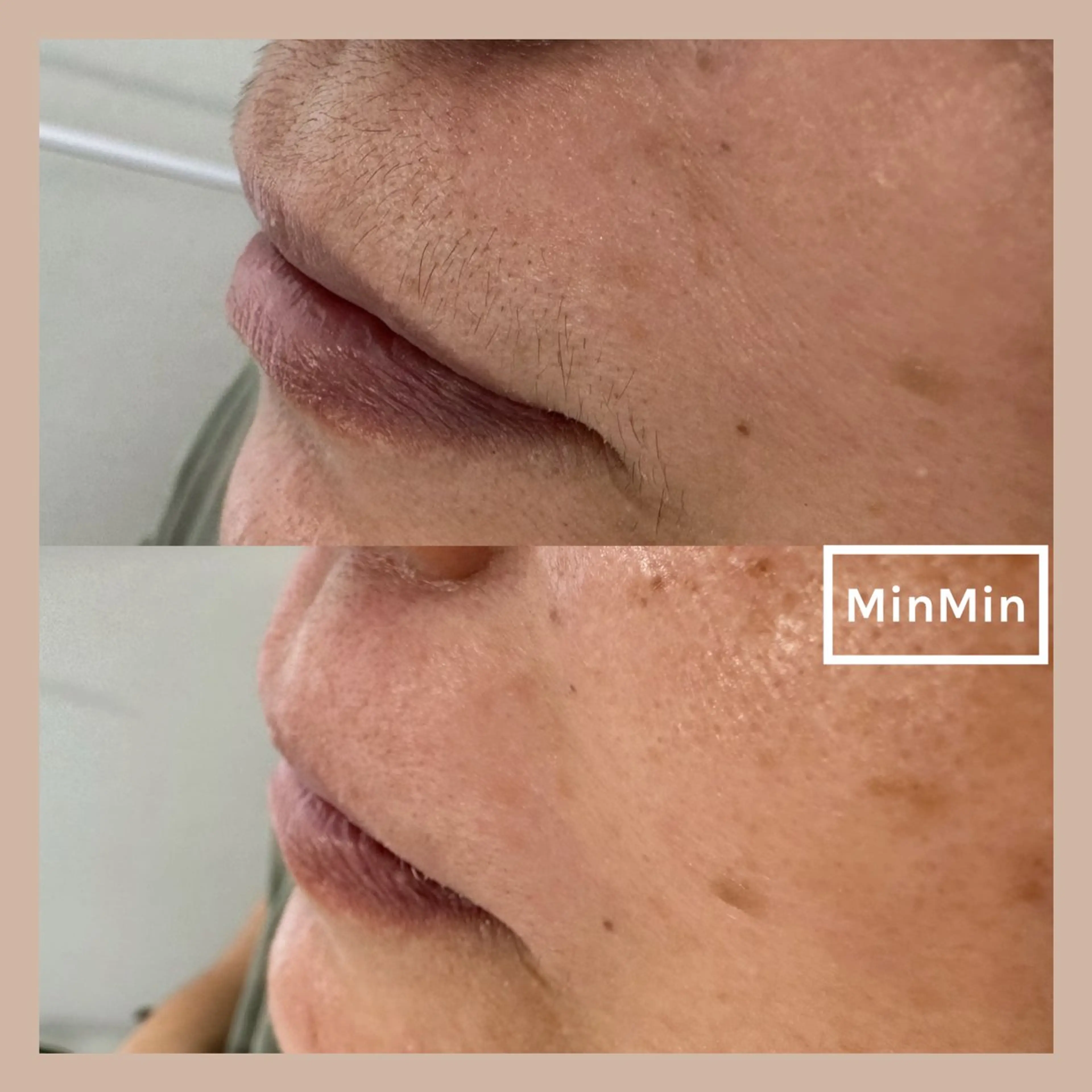 その他 Aime'e所属・野田 美早のマツエク・マツパデザイン