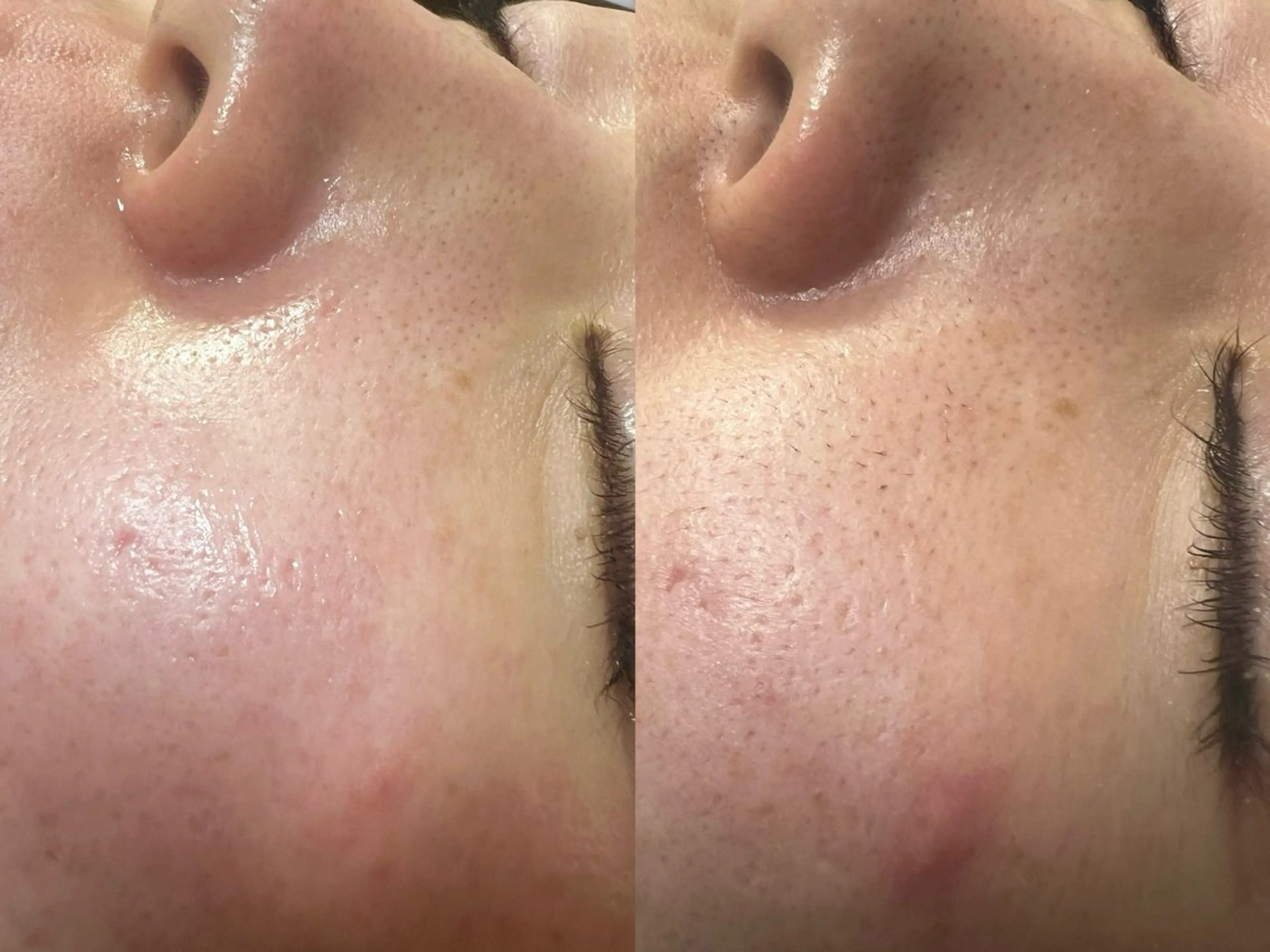 池袋脱毛 さとうのエステ・リラクイメージ