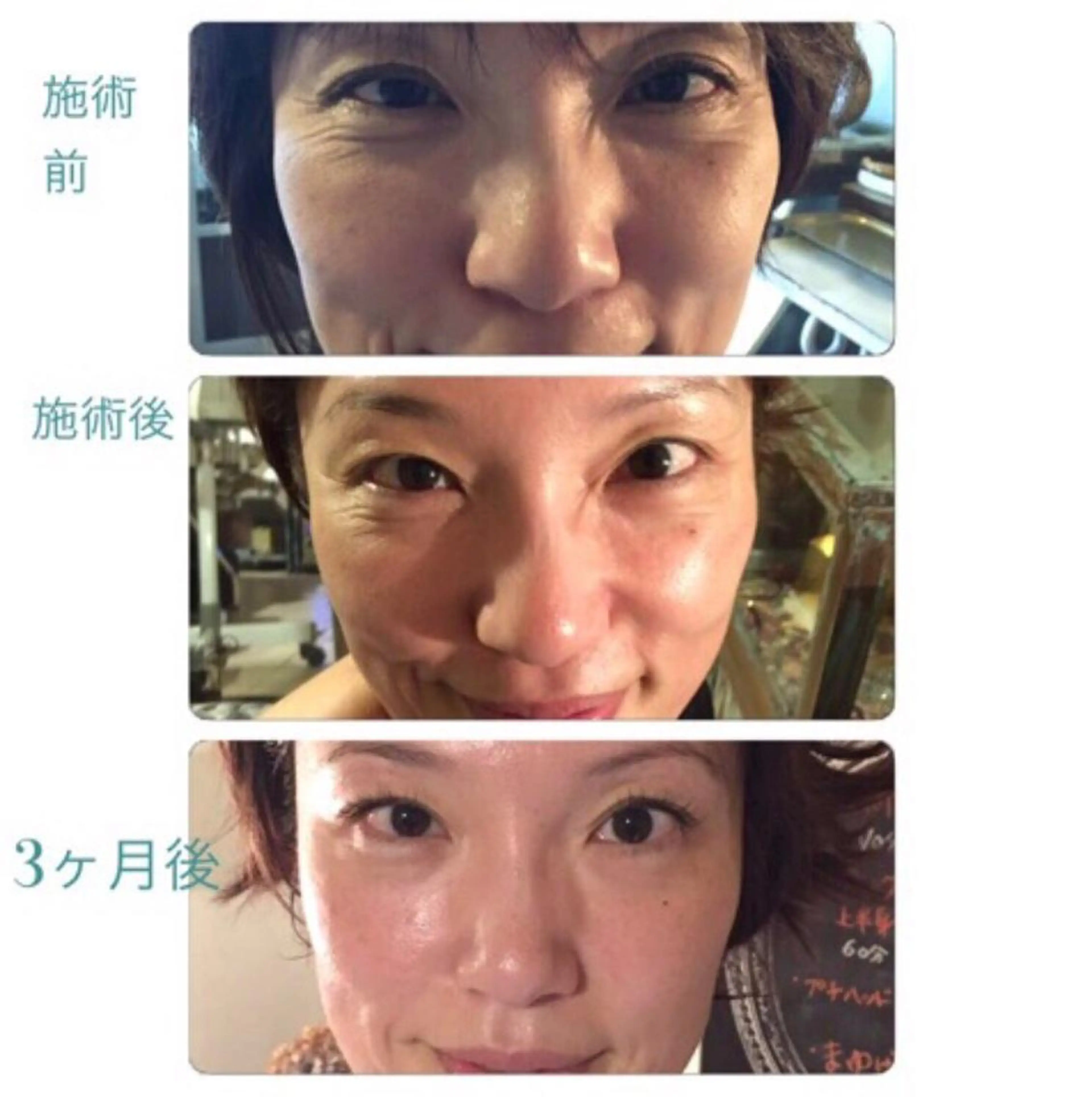 小顔バランス unicaのエステ・リラクイメージ