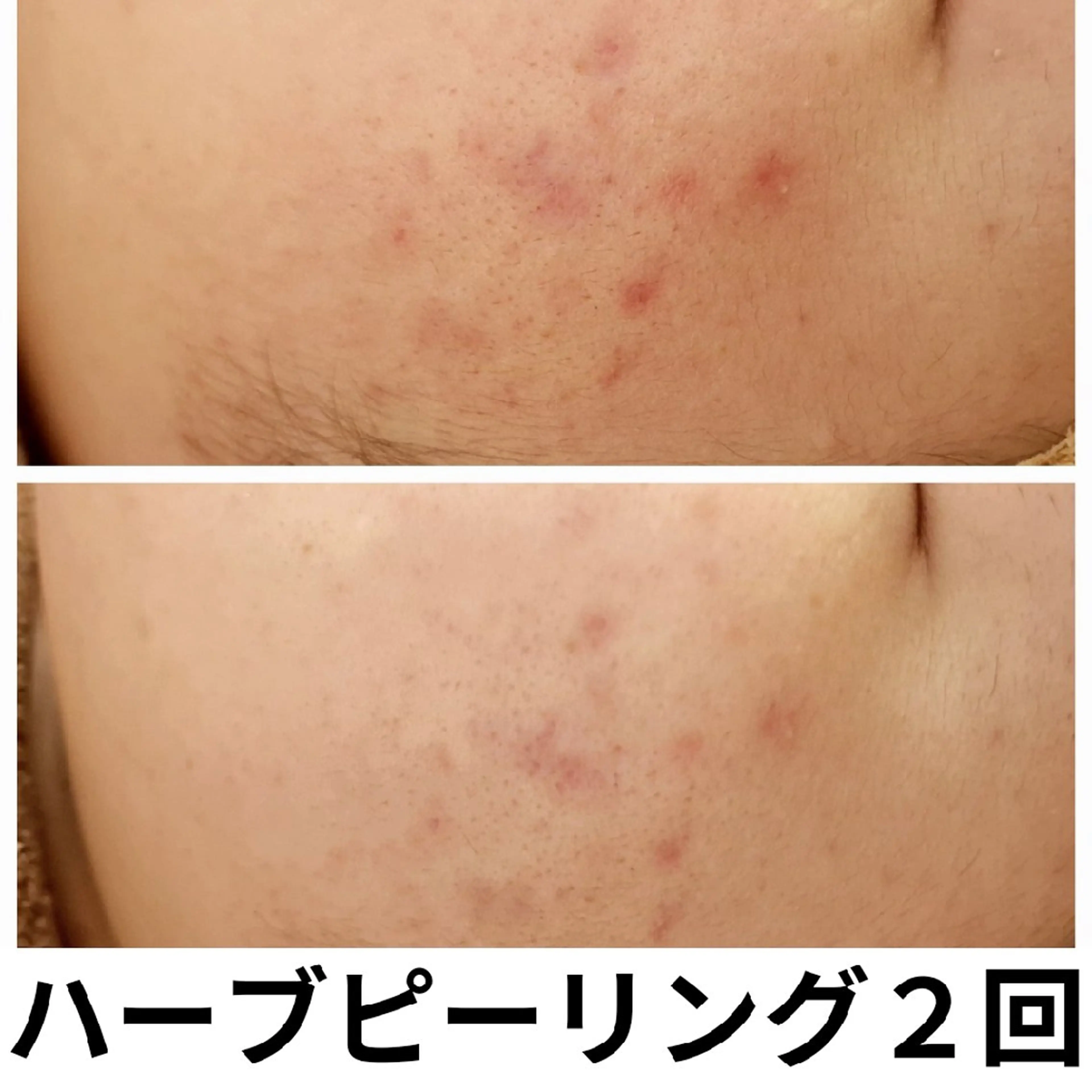 フェイシャル専門サロ ン　ERINのエステ・リラクイメージ