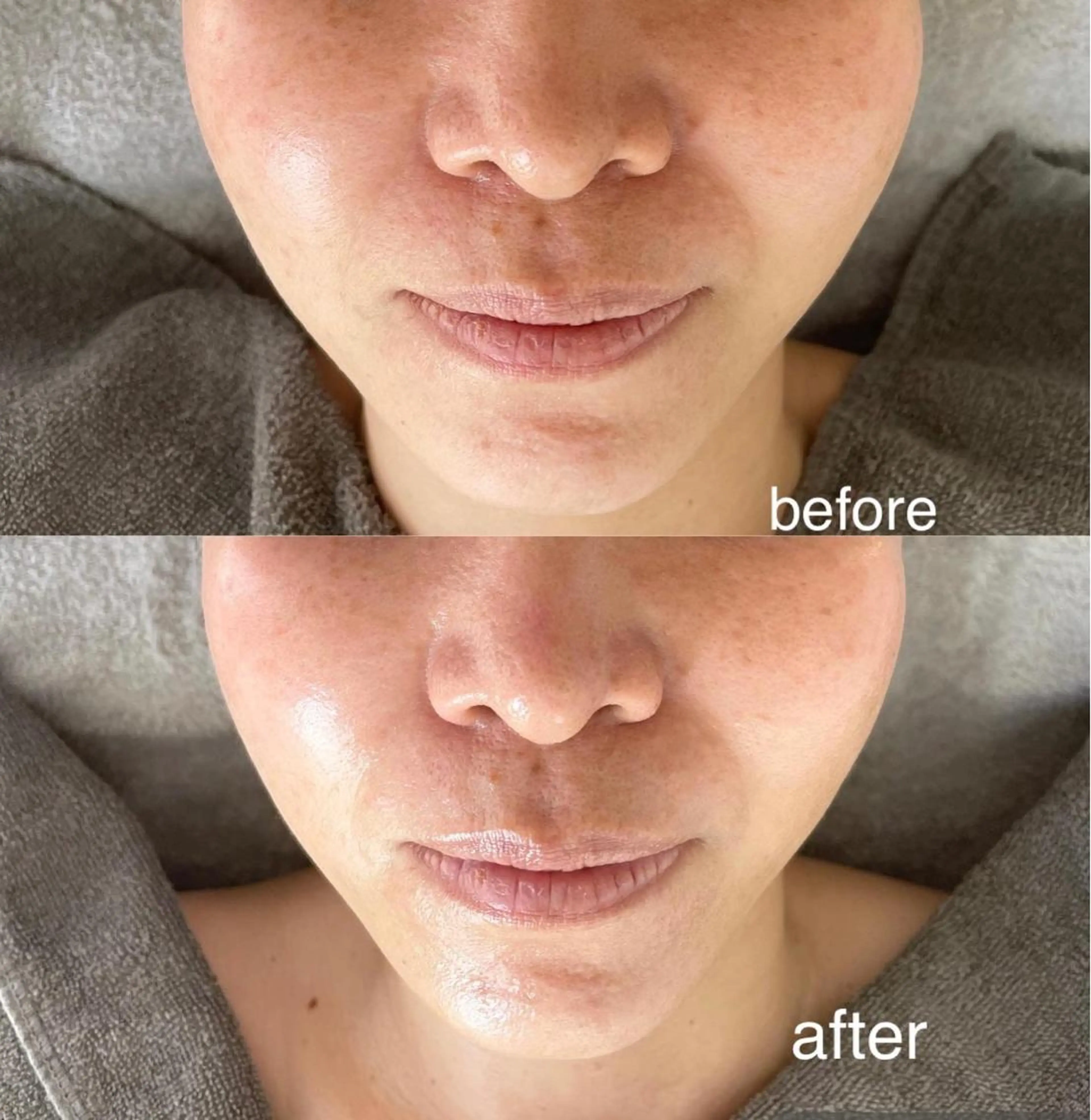 エステ 肌質改善サロン Ｌａｖｉ＆のその他イメージ