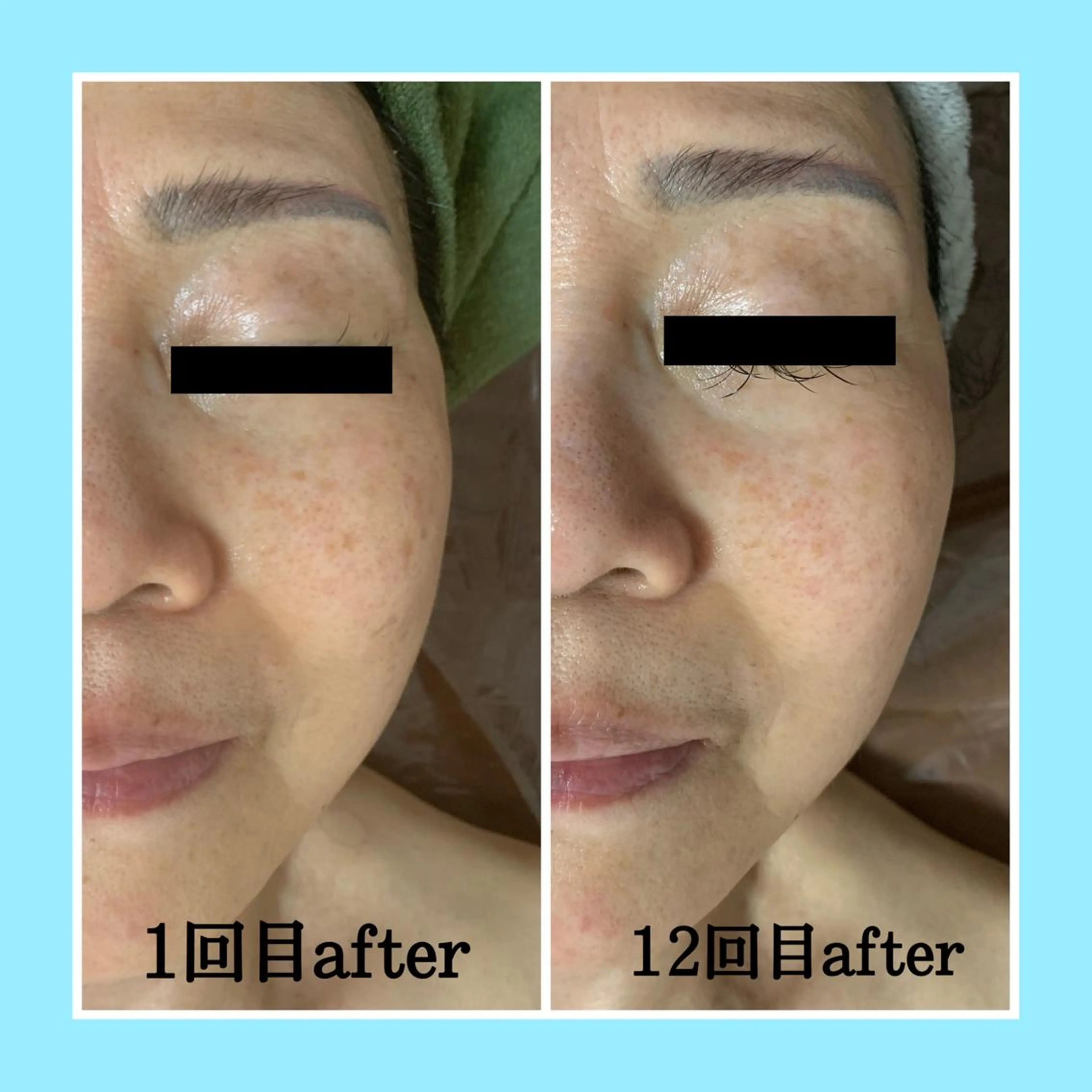 エステ ビューティーサロンLEMO所属・ビューティーサロン Lemoのエステ・リラクイメージ