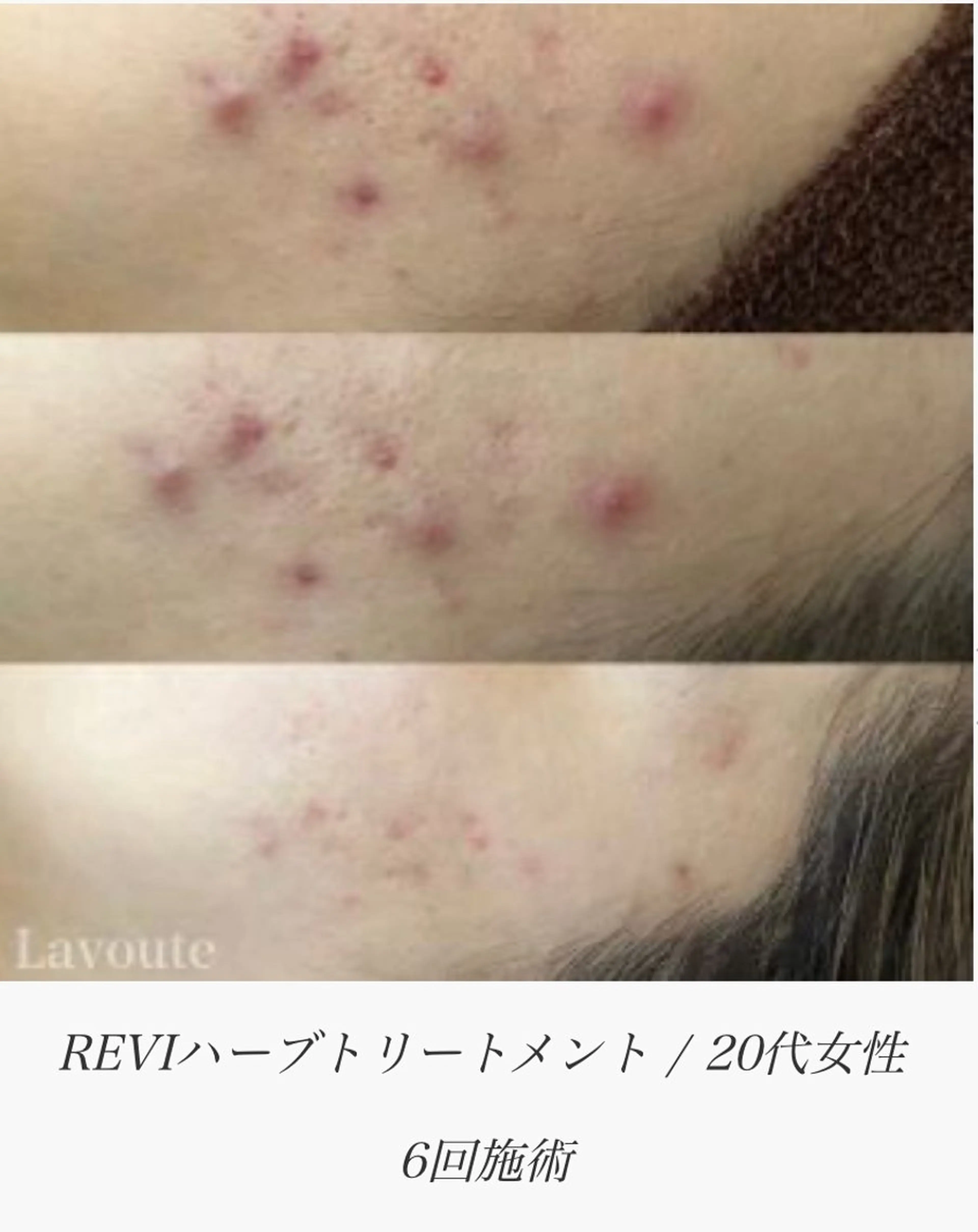 ネイル&エステ phuan(プアン)のネイルデザイン