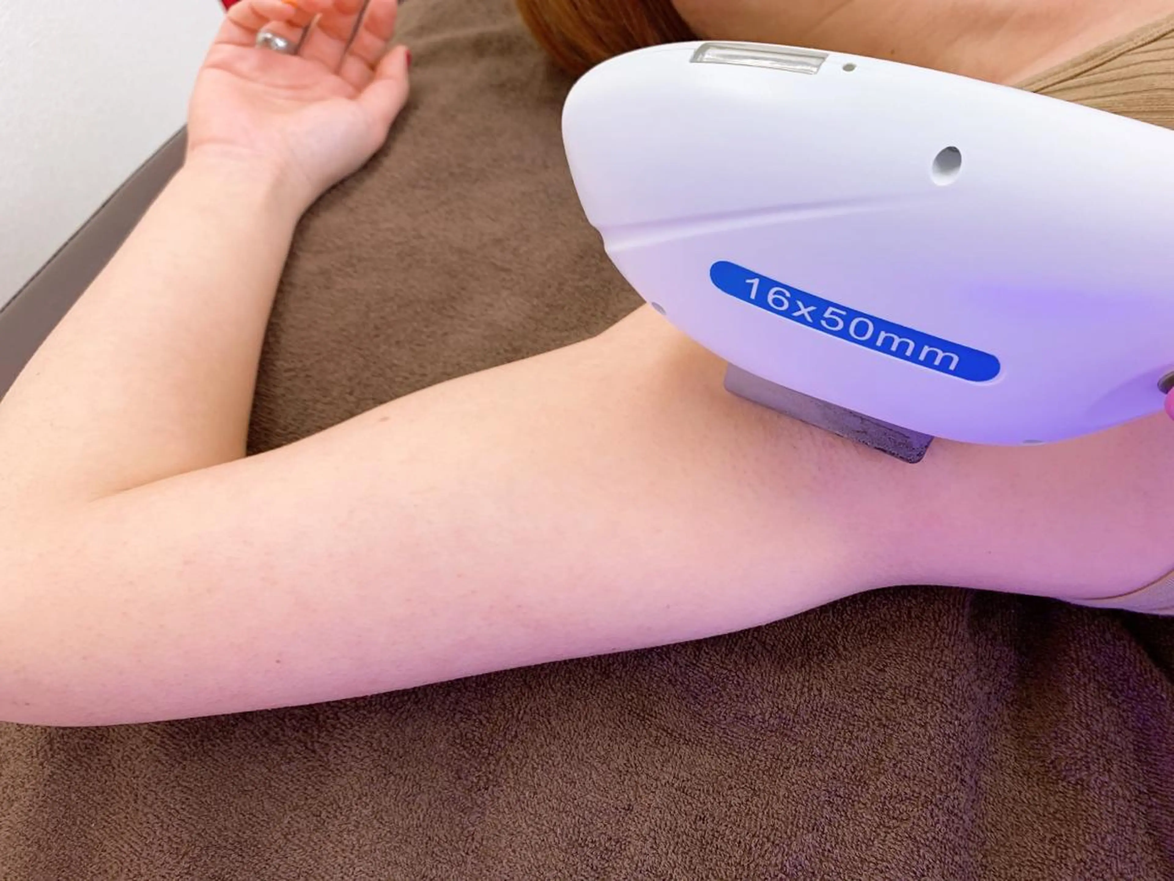 ワキ脱毛の写真