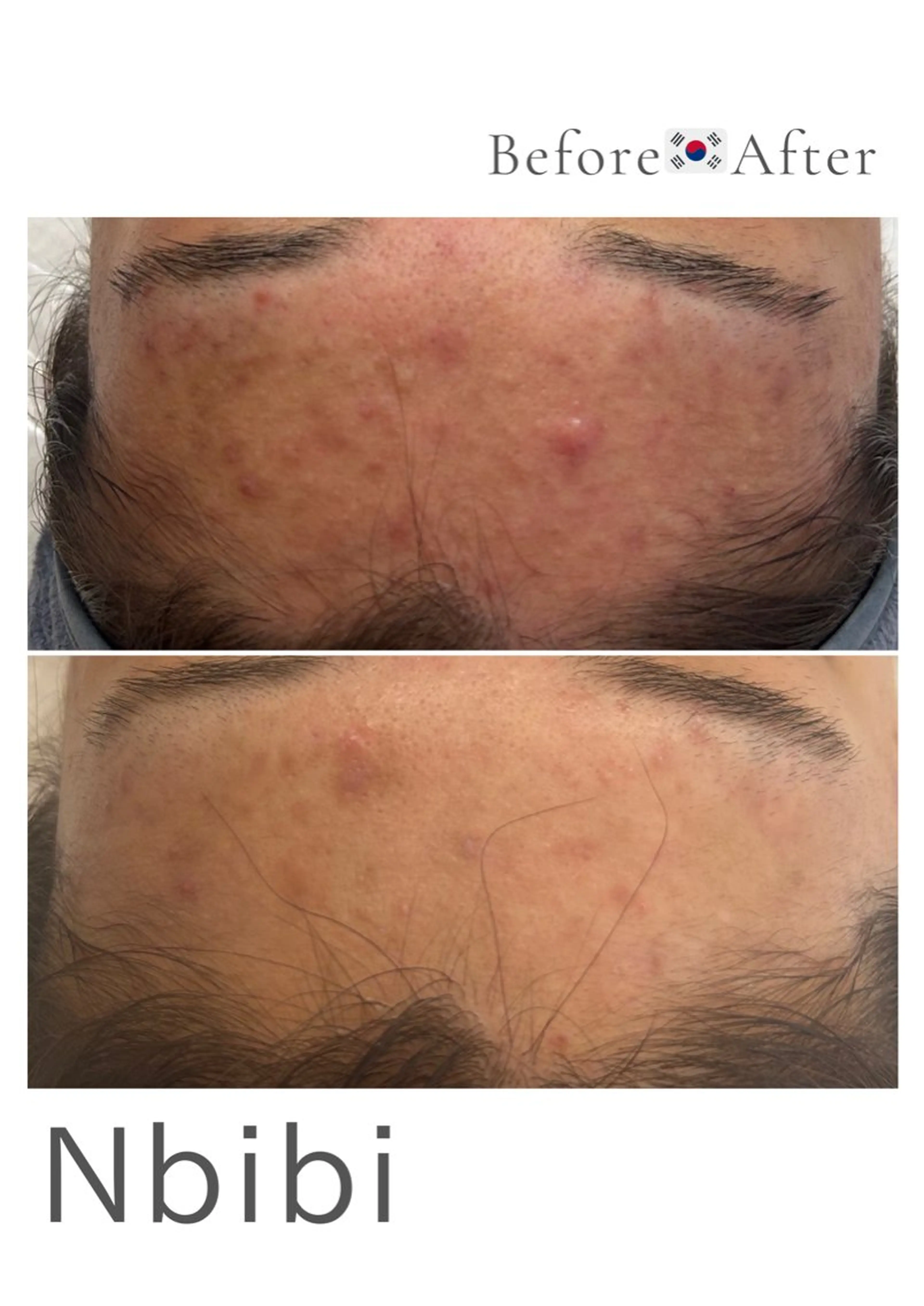 韓国🇰🇷価格 サロン_Nbibiの眉毛・アイブロウイメージ