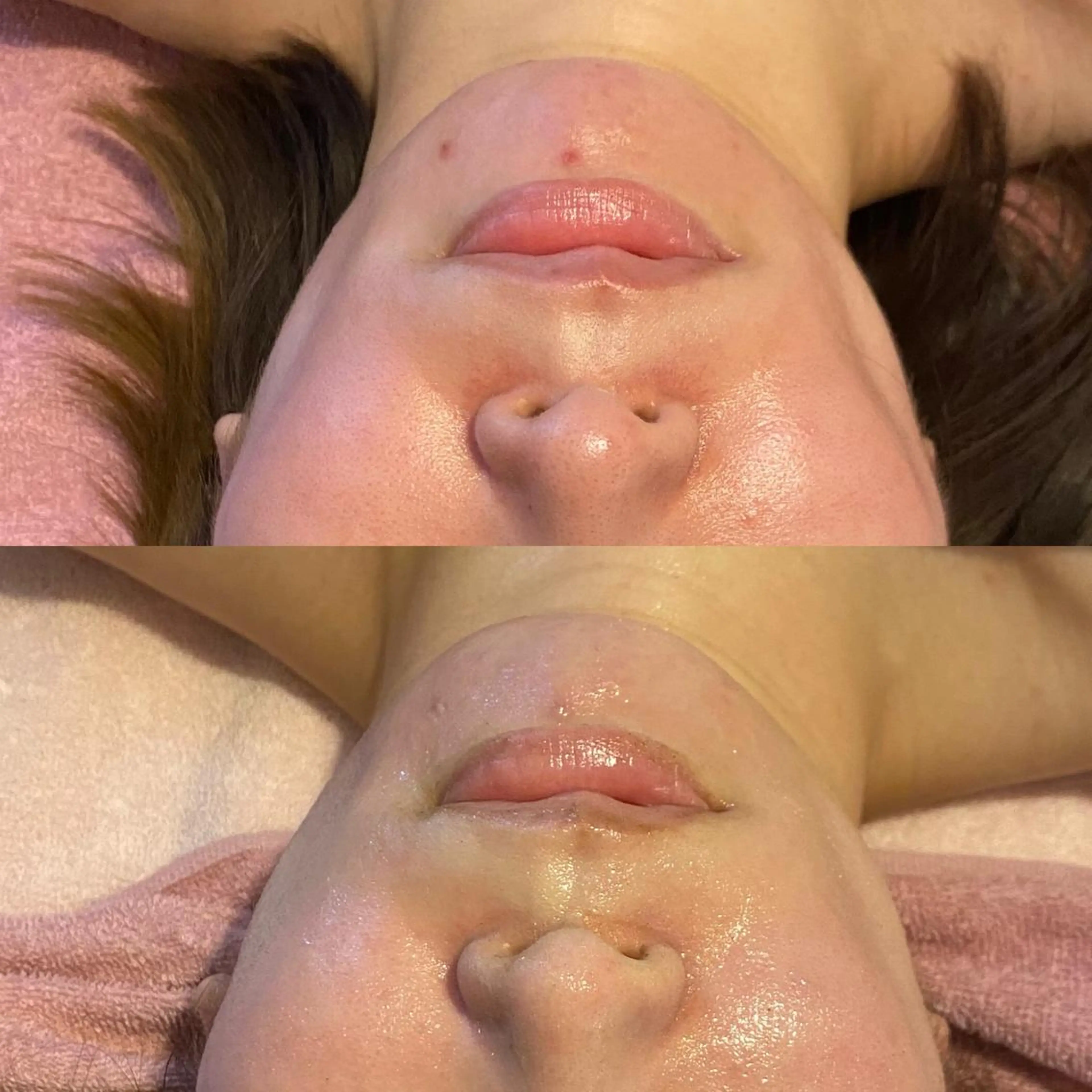 Meetite 小林のエステ・リラクイメージ