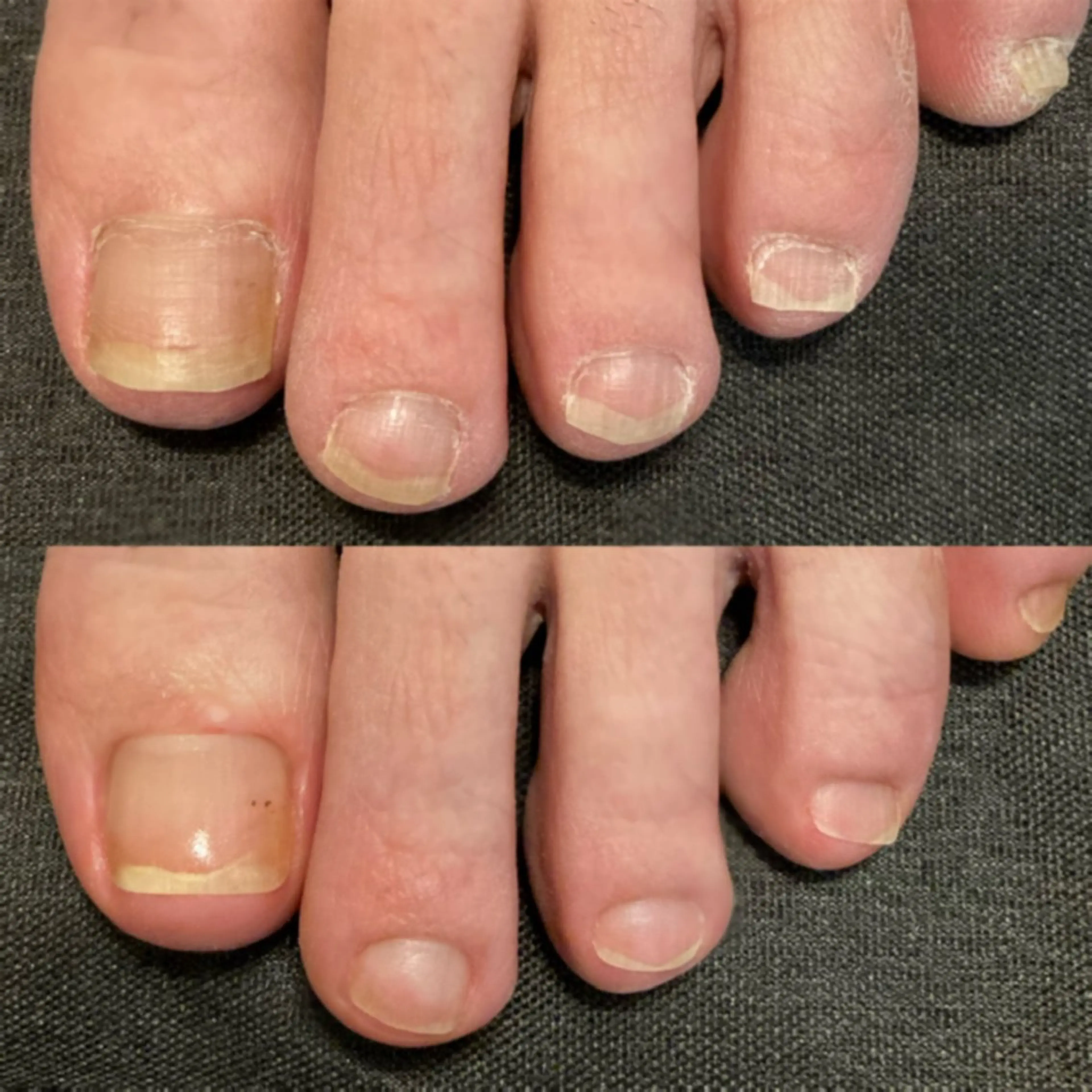 フットネイルケアの写真