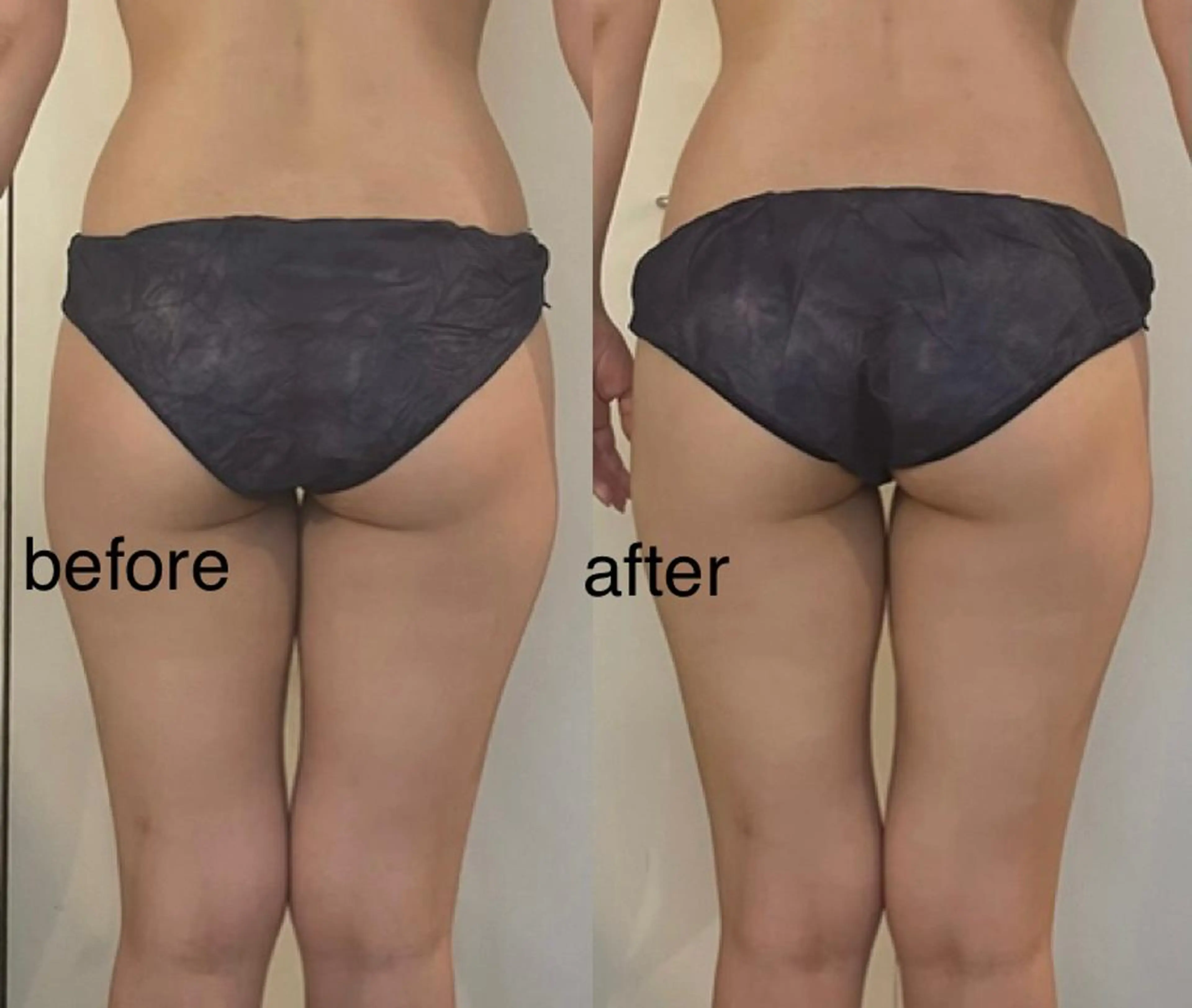 エステ リラク プライベートサロン シュシュのエステ・リラクイメージ