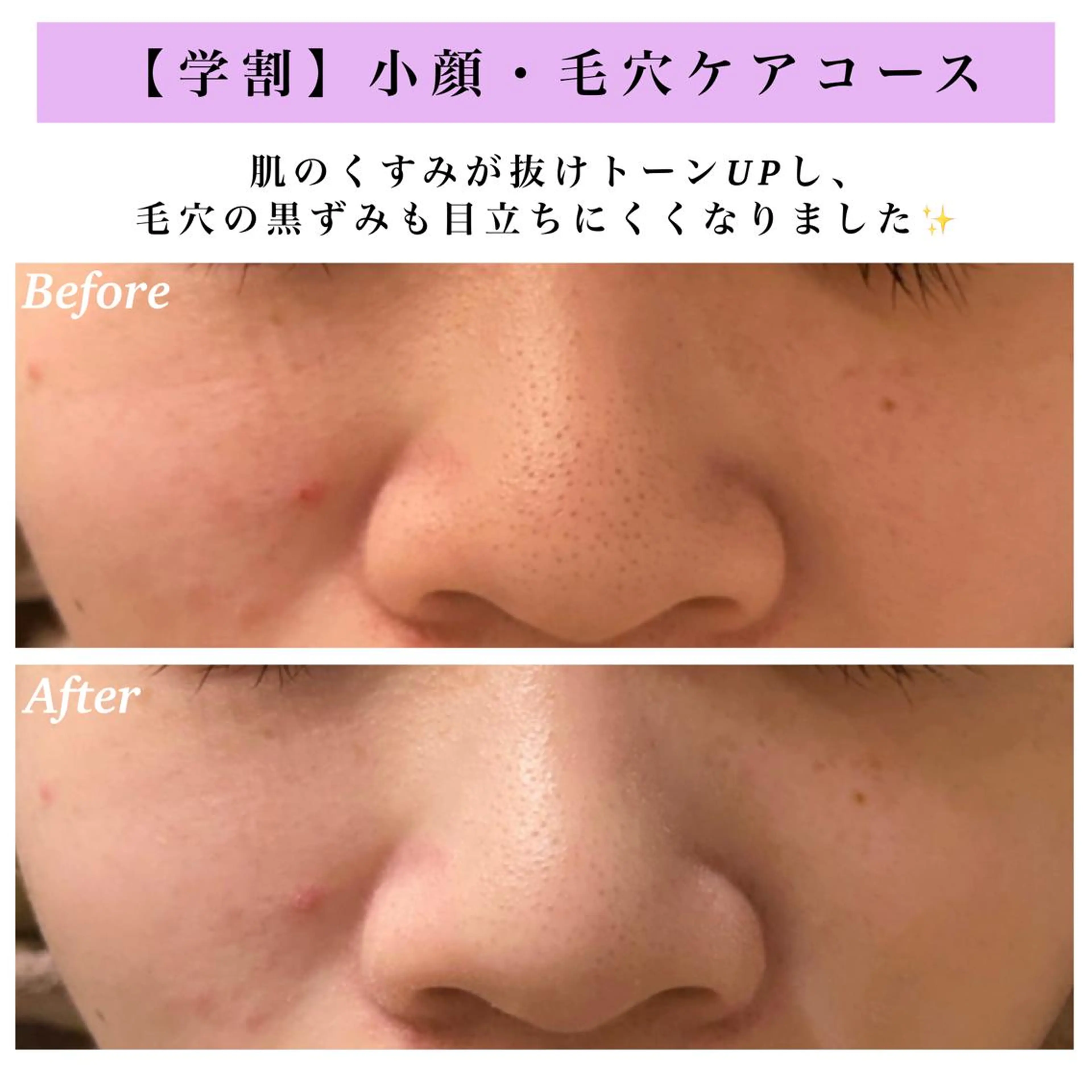 Bellesthe （ベルエステ）のエステ・リラクイメージ