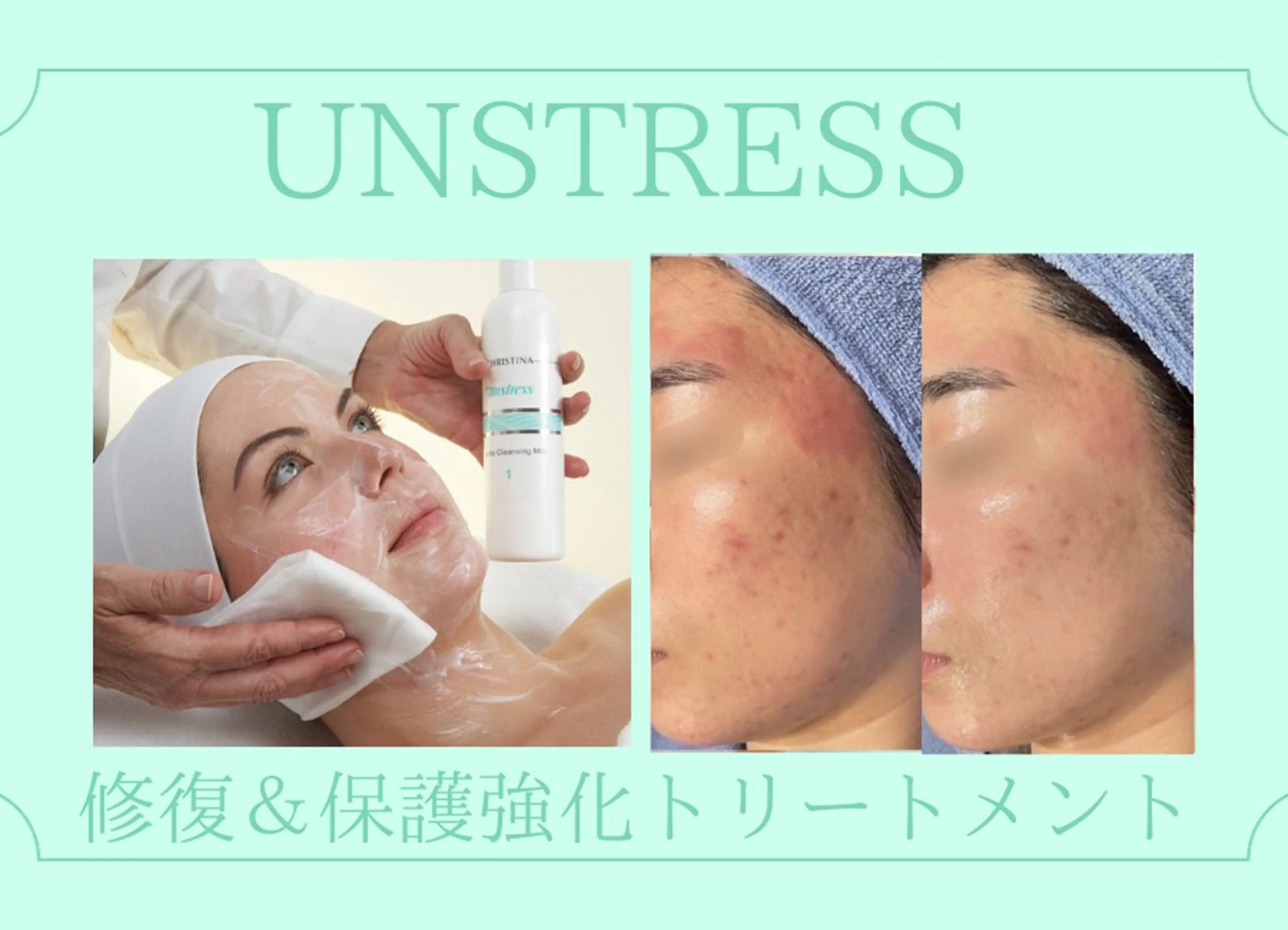 エステ BestBelleꕤ 大阪福島/肌質改善のエステ・リラクイメージ