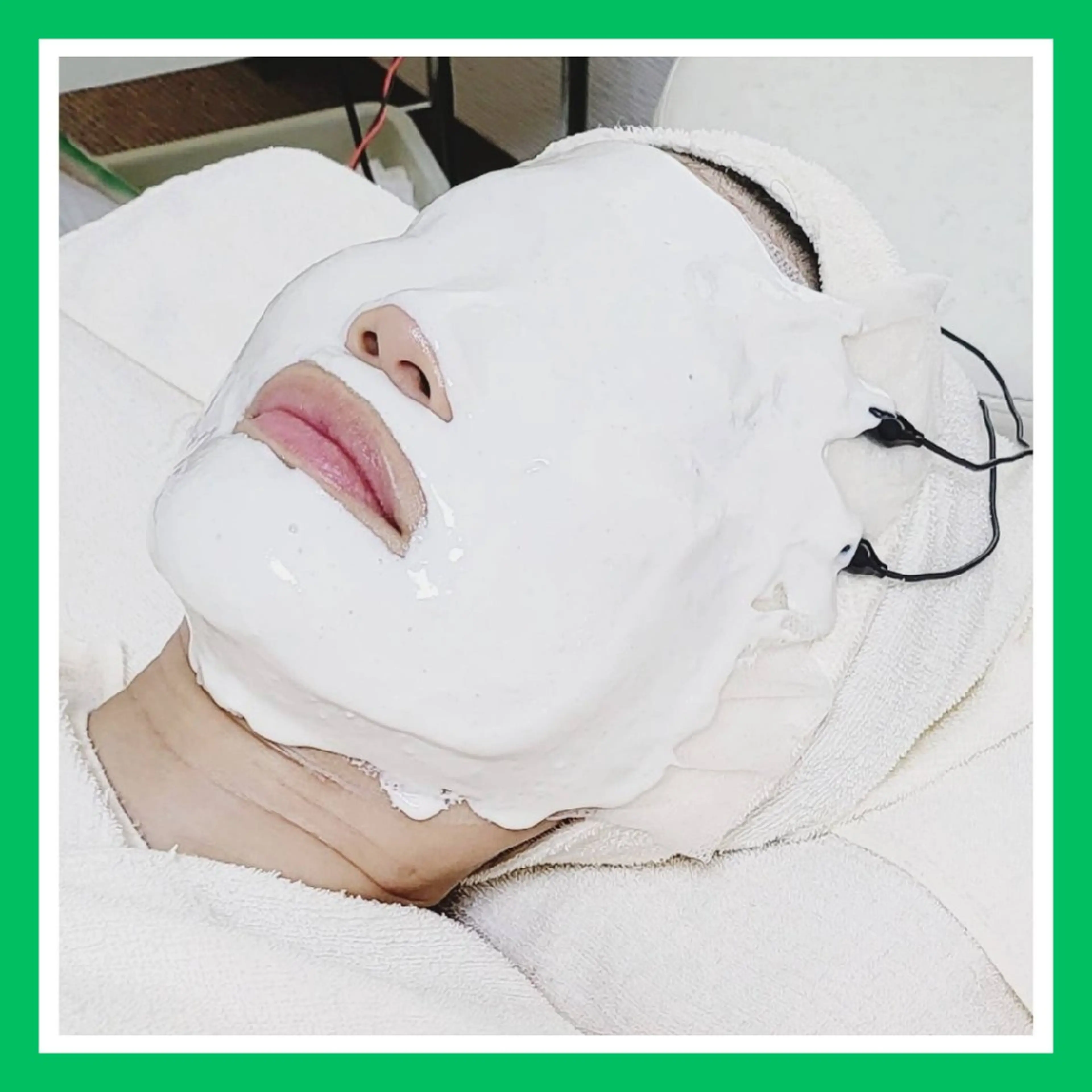 ニキビケア◇ニキビ跡 レゾン京橋店　峠山のエステ・リラクイメージ