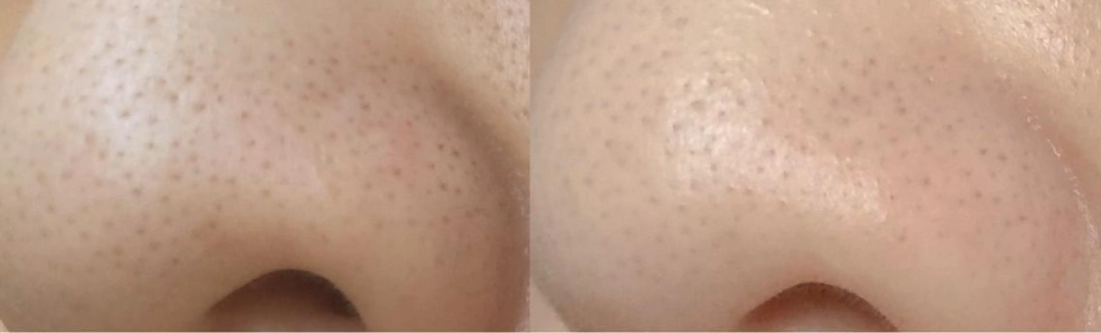 朝重い人専用 肩甲骨調整のエステ・リラクイメージ