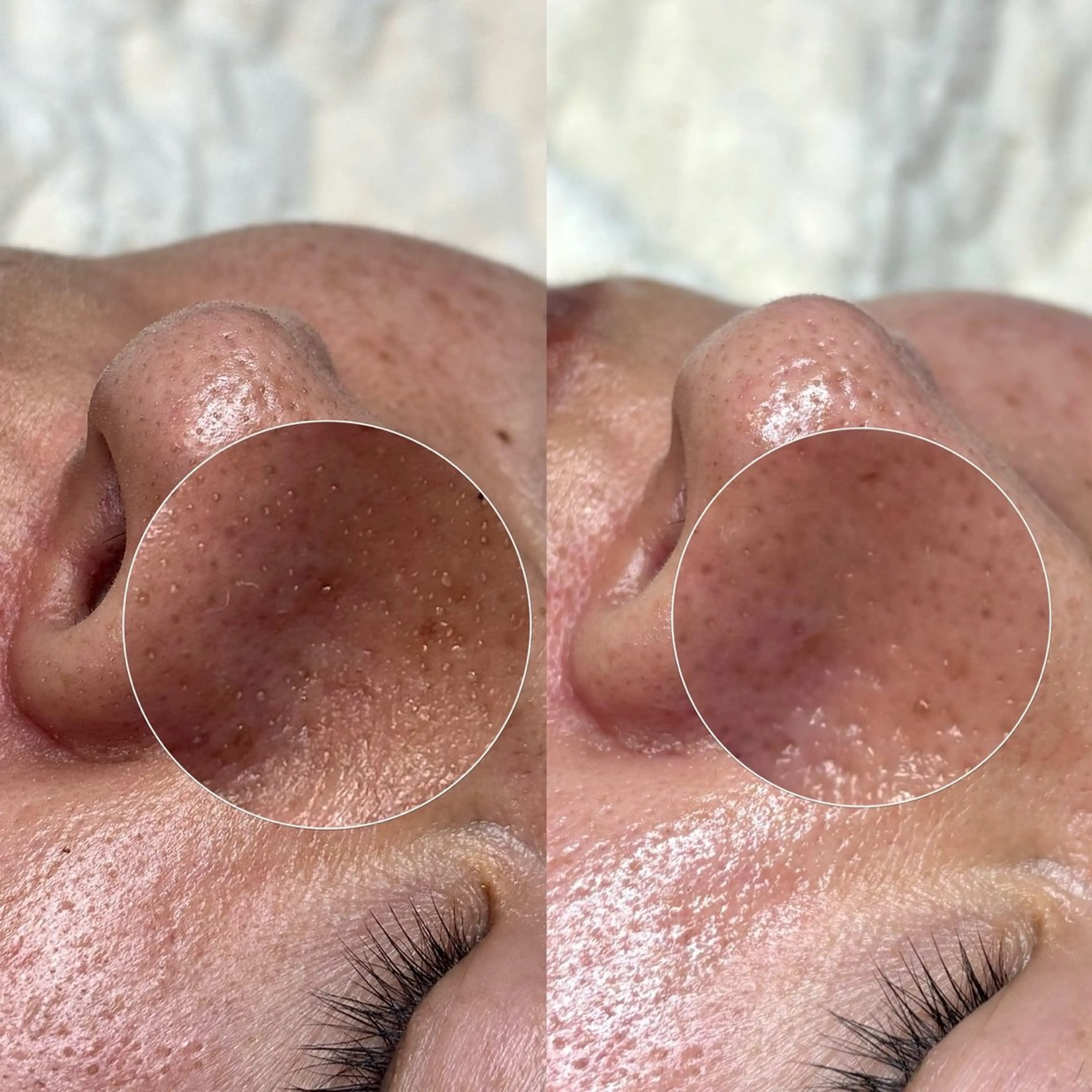 Suu.千種/今池 毛穴洗浄/韓国肌管理の眉毛・アイブロウイメージ