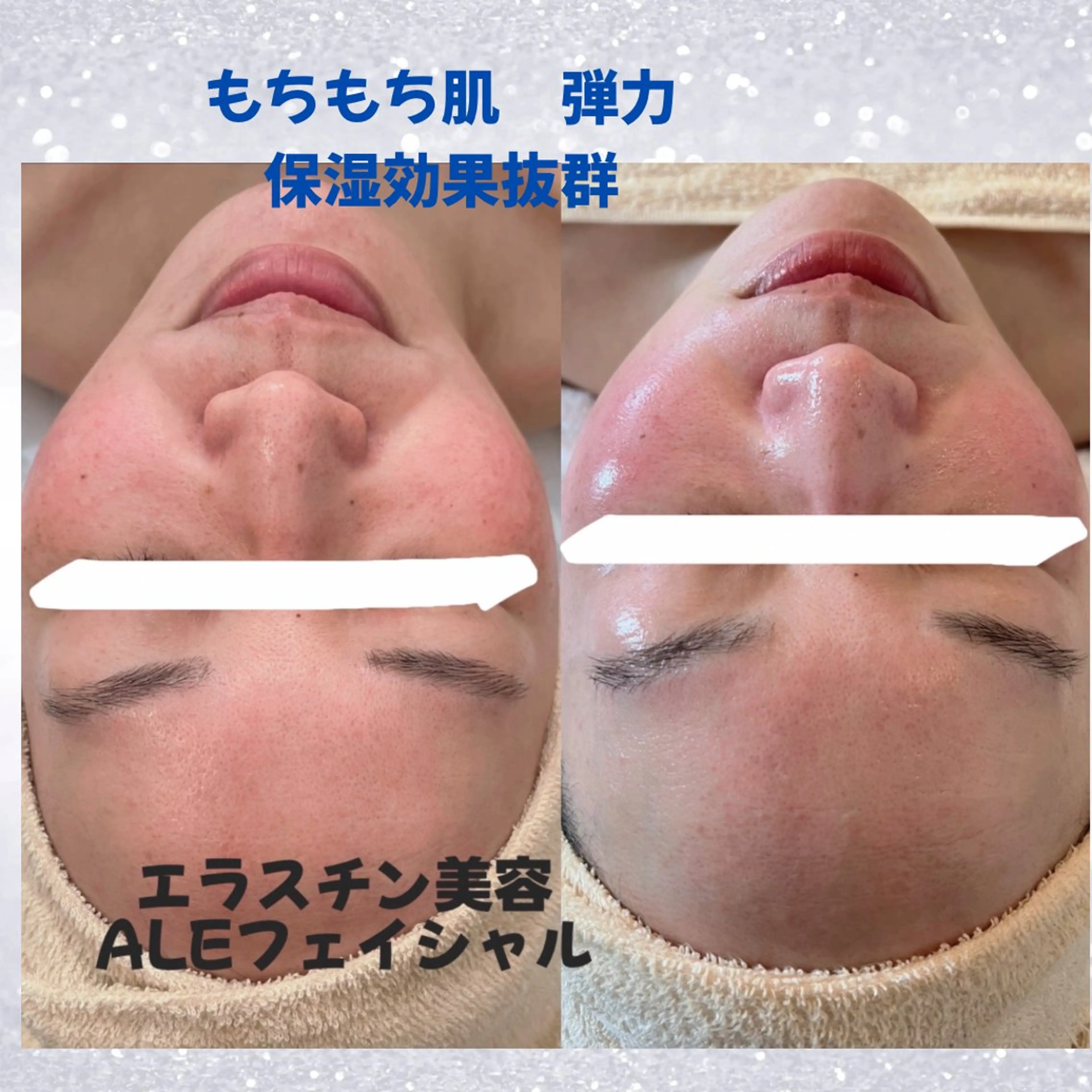 エステ beauty SalonRcoinのマツエク・マツパデザイン