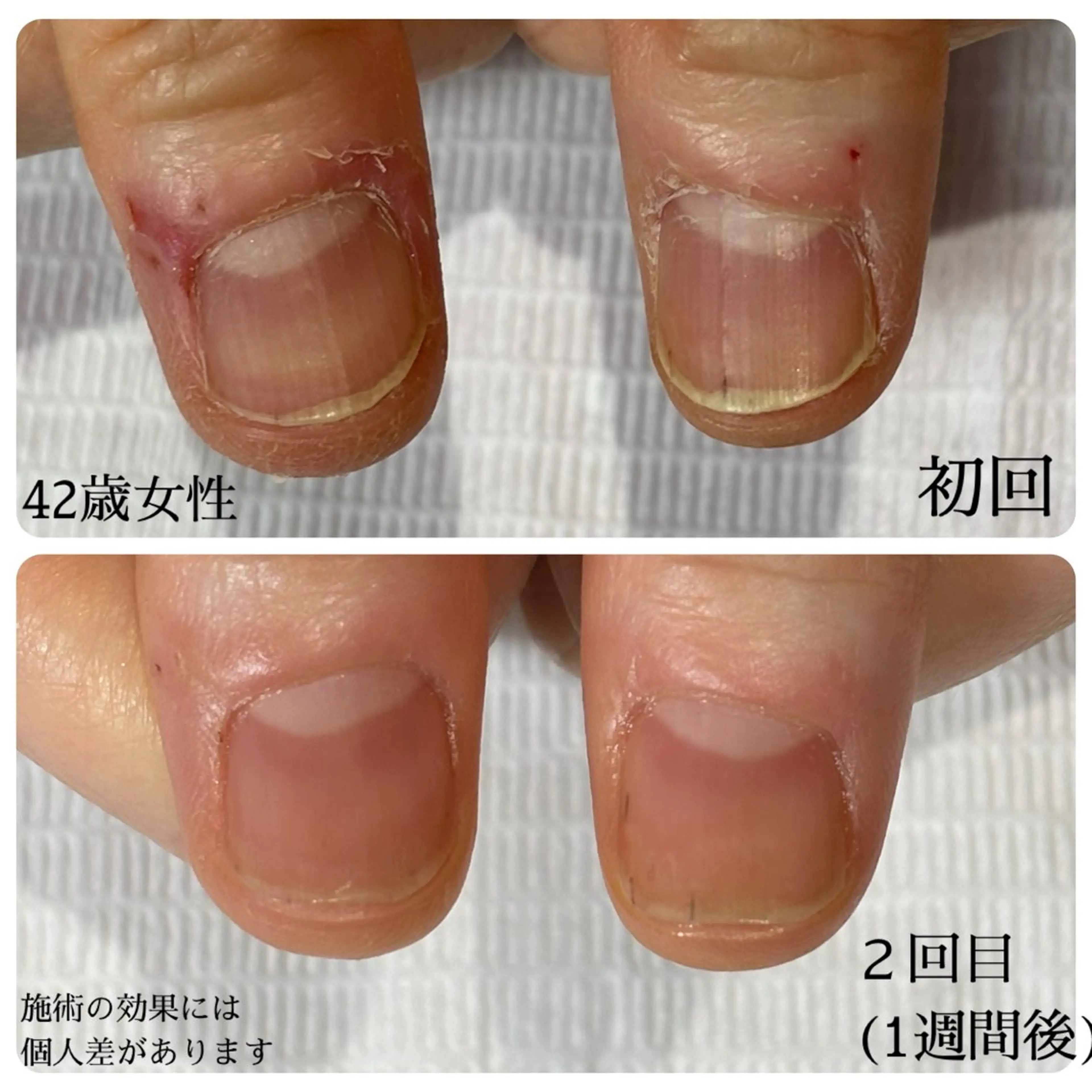 ネイル 自爪育成専門サロン エムロードゥ池下のネイルデザイン