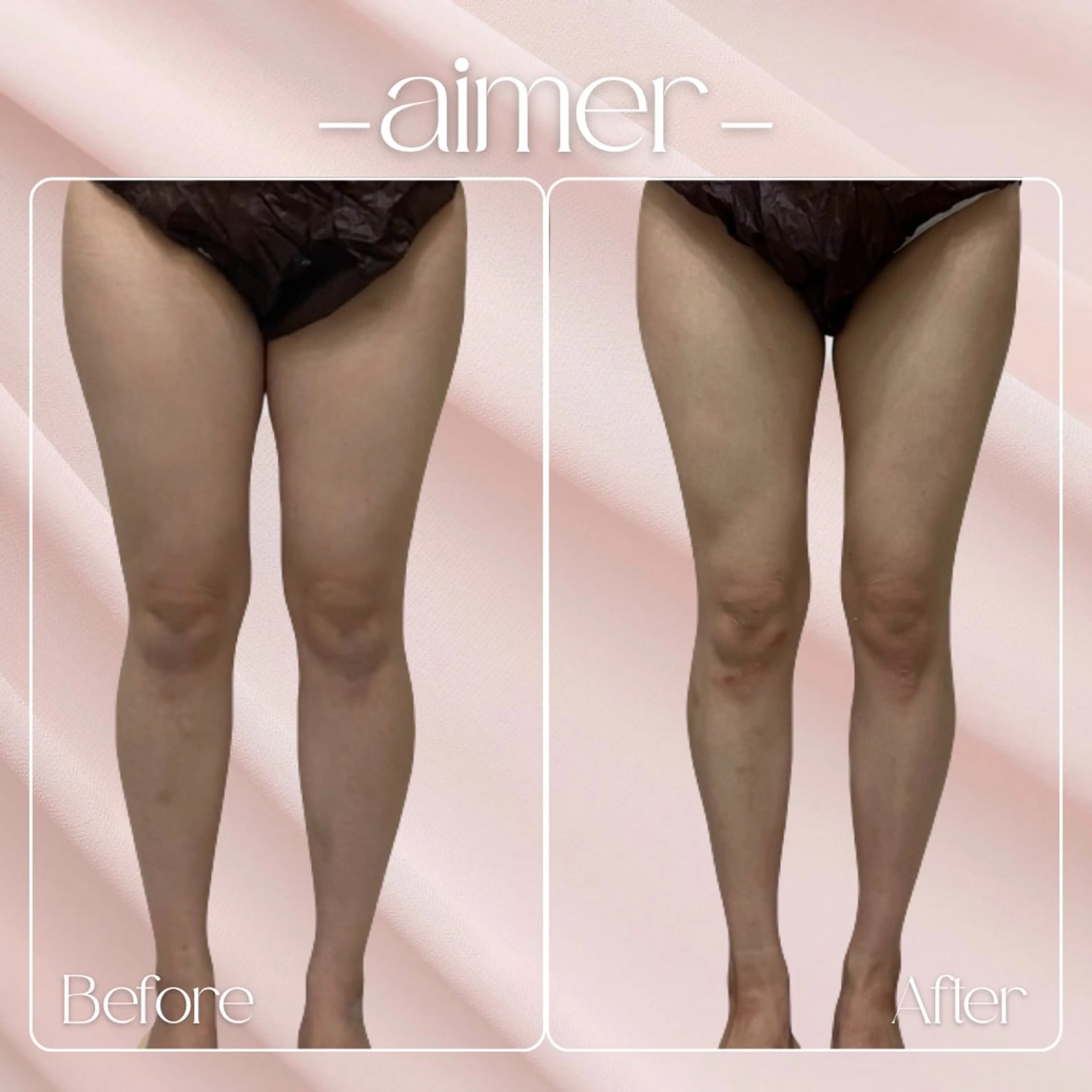 aimer 島田のエステ・リラクイメージ