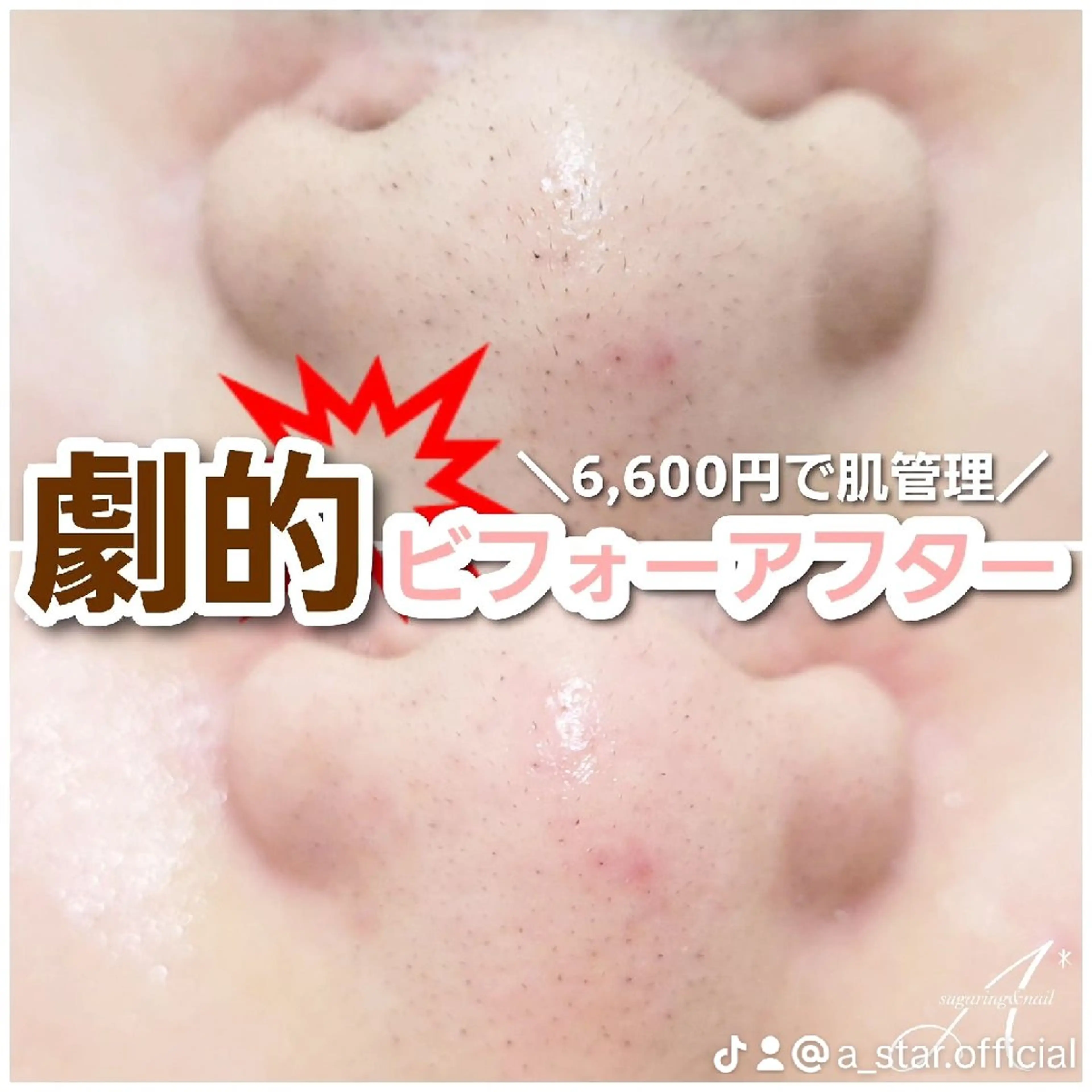 A*《エースター》 シュガーリング🍋のエステ・リラクイメージ