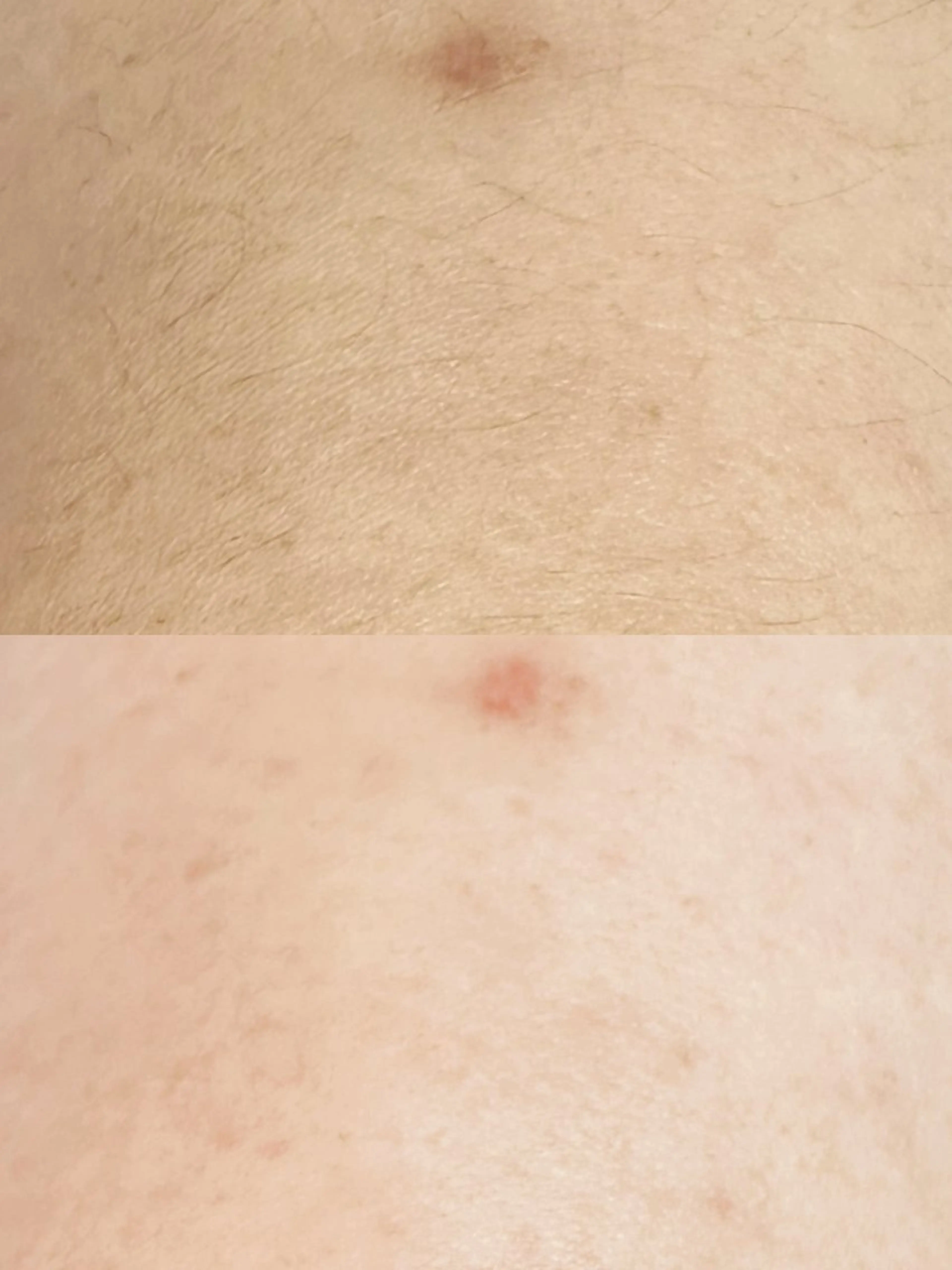 Hitomi シュガーリング豊橋のその他イメージ