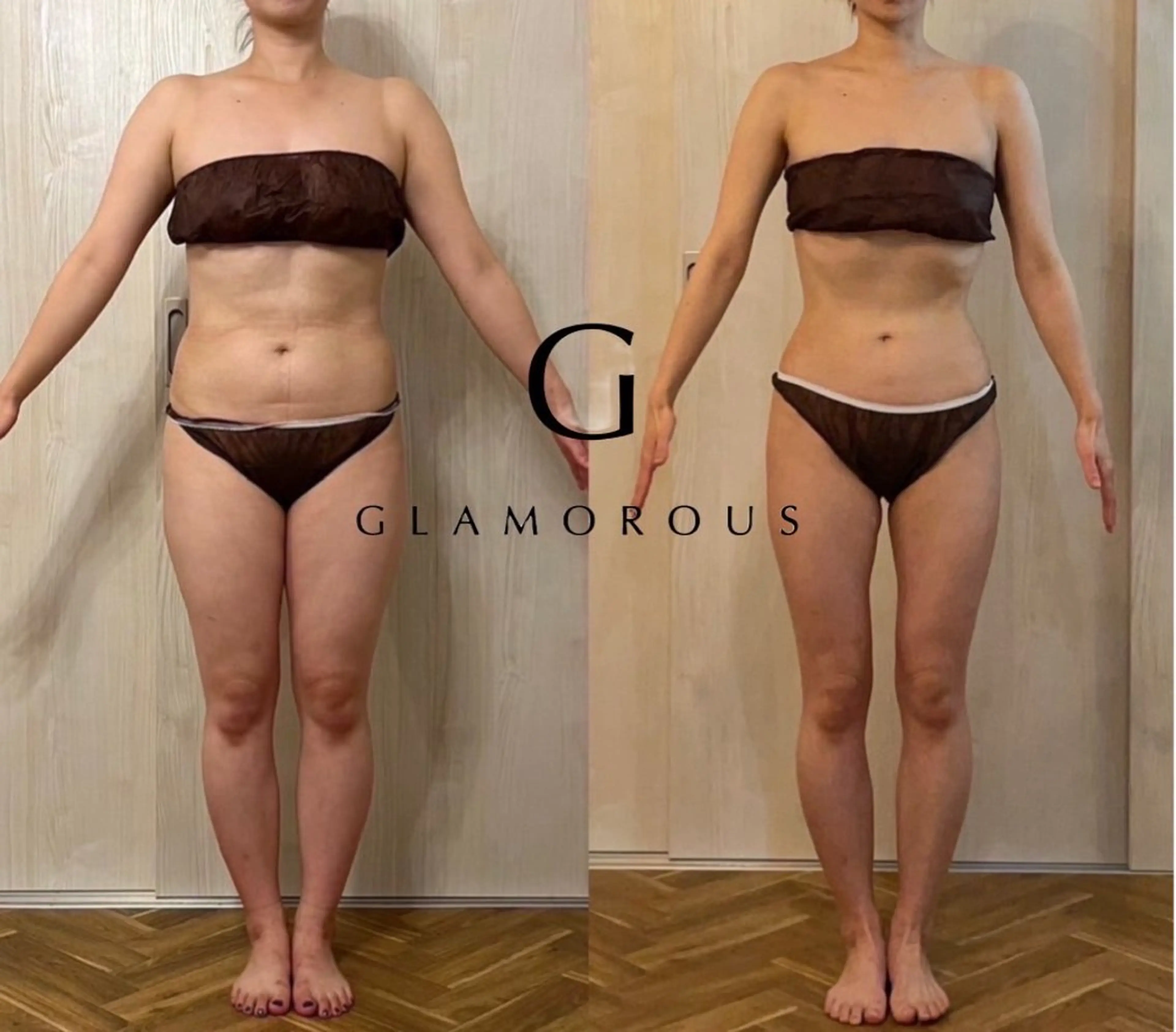 人生最後のダイエット❤️無料カウンセリングの写真