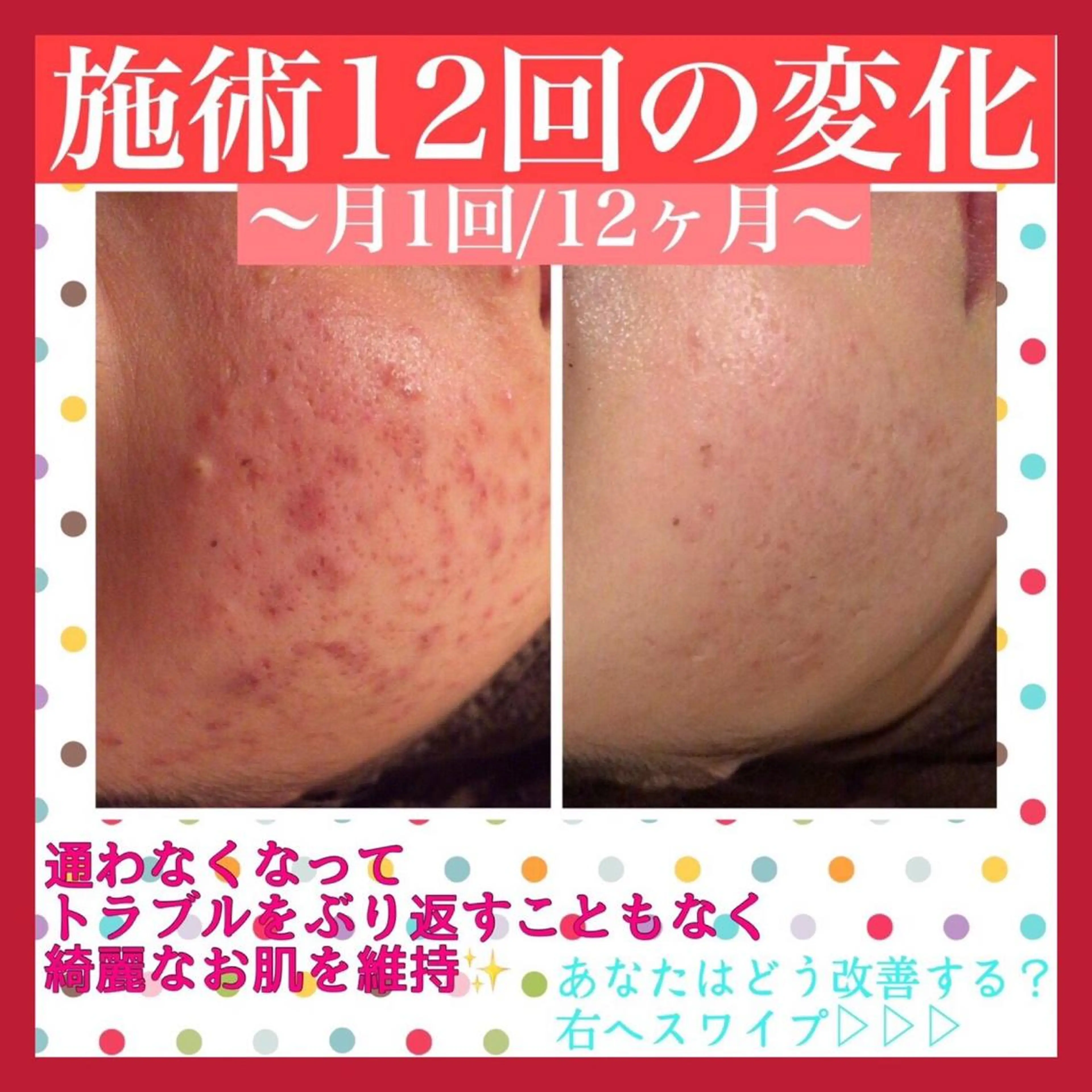 ミディアム カラー パーマ ヘアアレンジ メンズ キッズ ネイル マツエク・マツパ エステ リラク ニキビ・肌質改善専門 ♡人生が変わるサロンのエステ・リラクイメージ