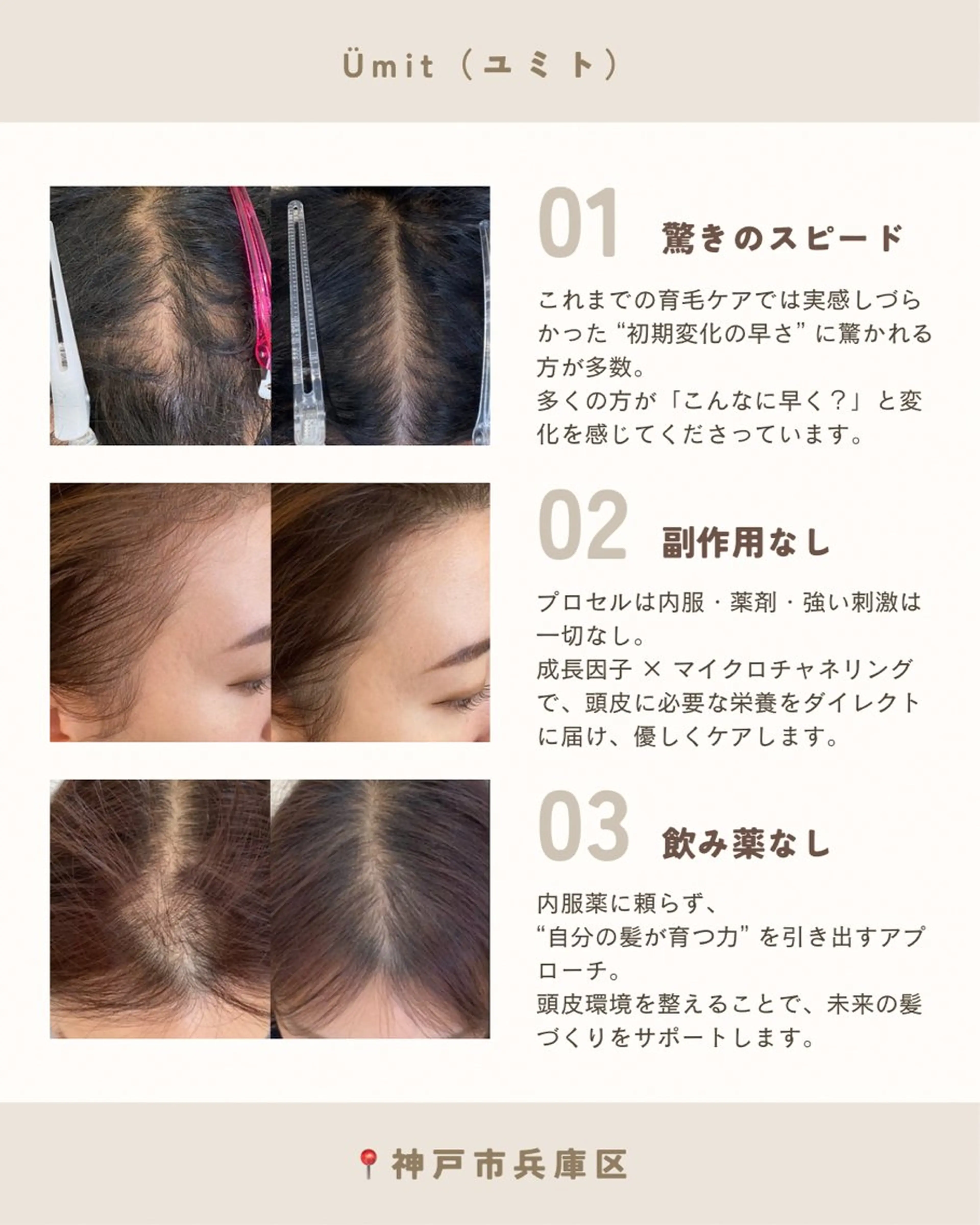 メンズ ヘッドスパ Ümit（ユミト） プロセルセラピーズのネイルデザイン