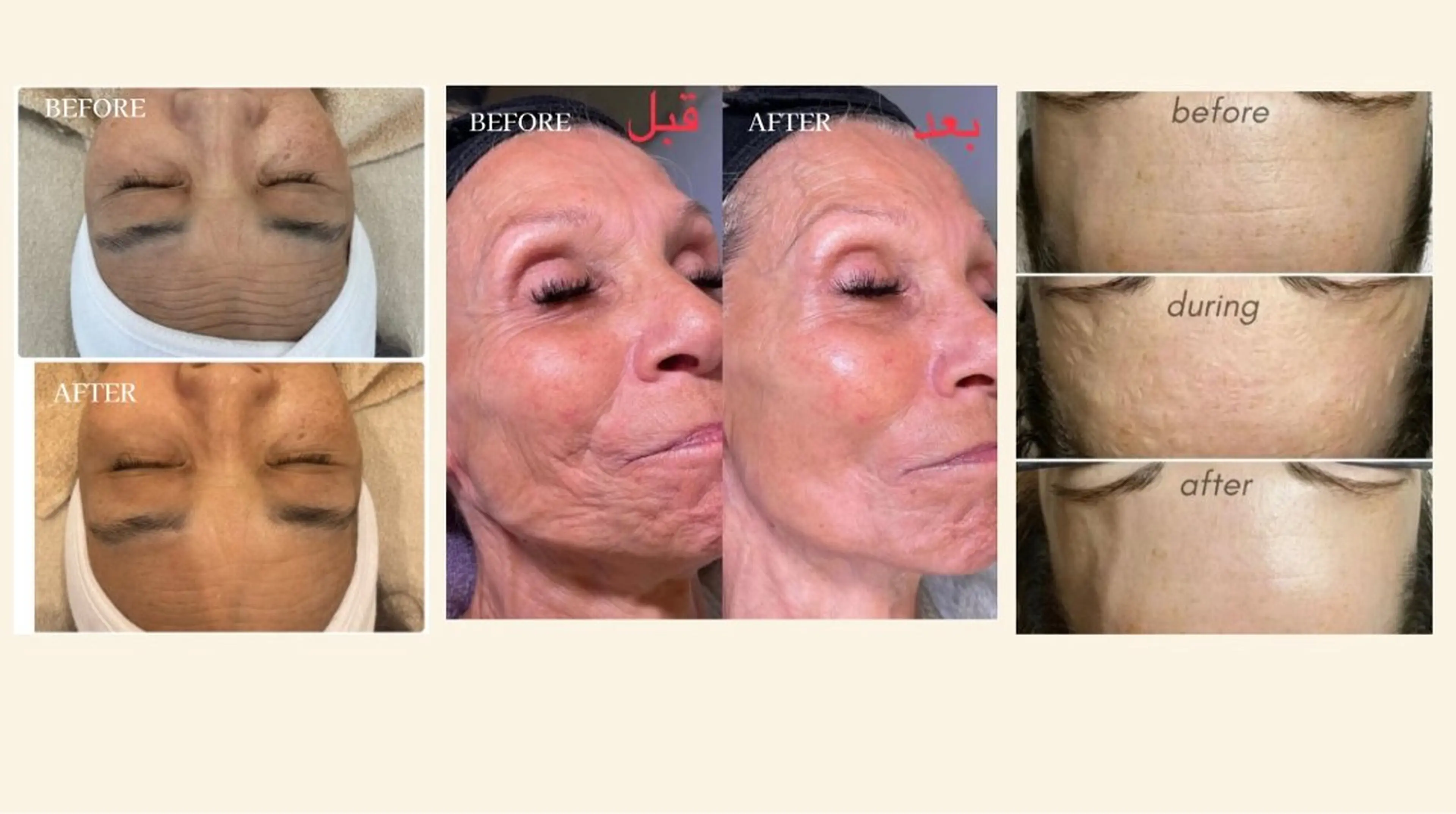 医療提携Beauty SalonMuseのエステ・リラクイメージ