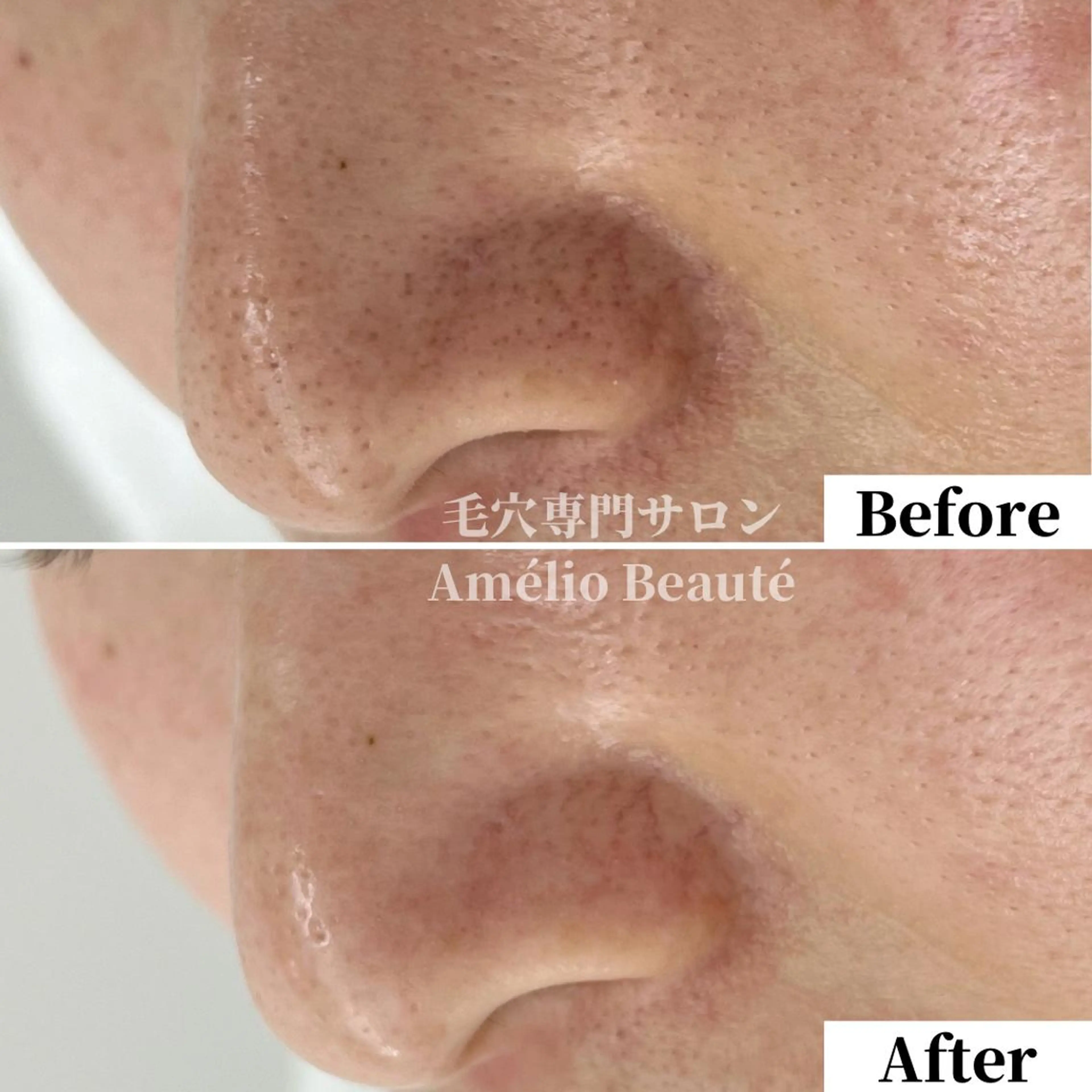 毛穴ケア専門サロン アメリオボーテのその他イメージ