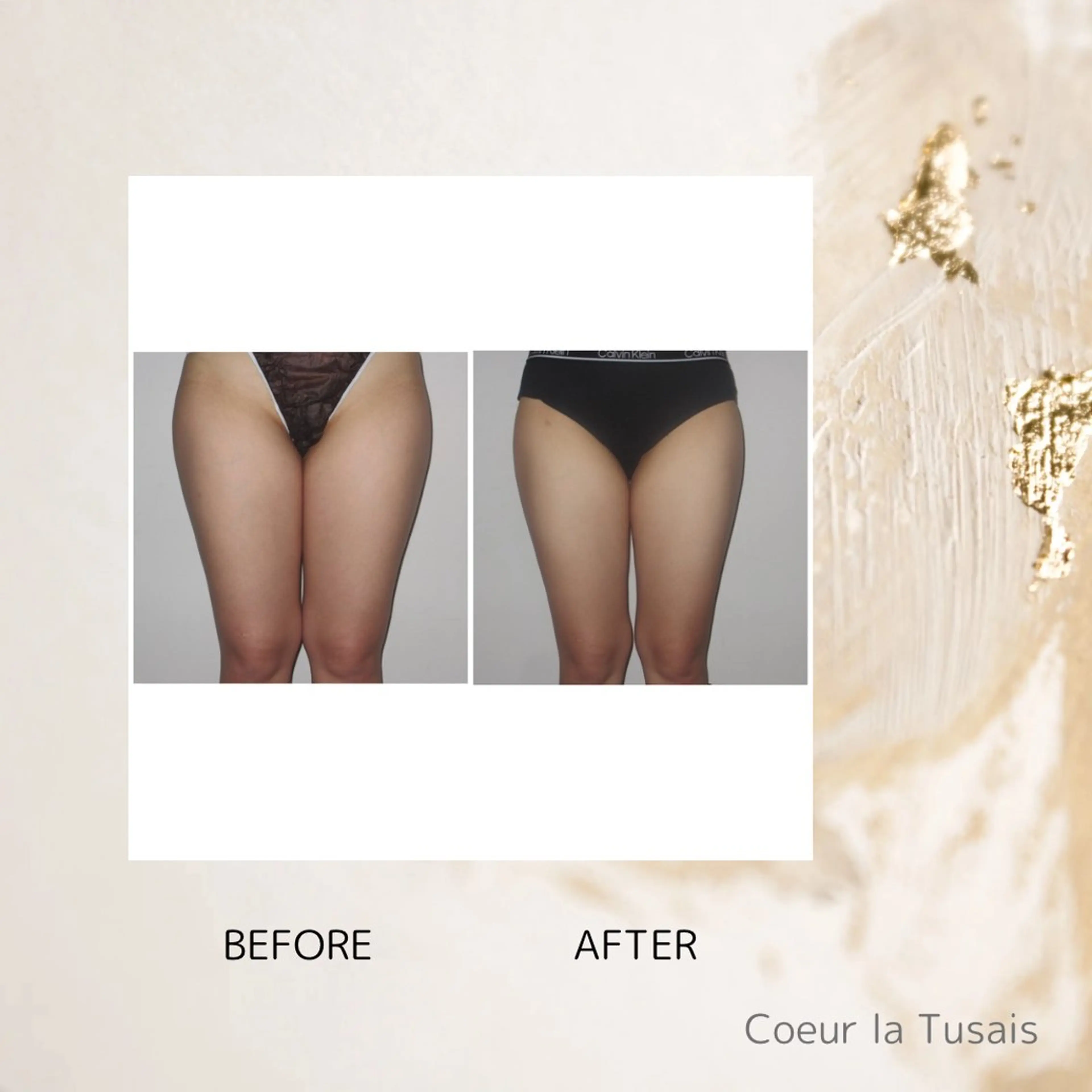 エステ coeur la tusais ゆうきのエステ・リラクイメージ