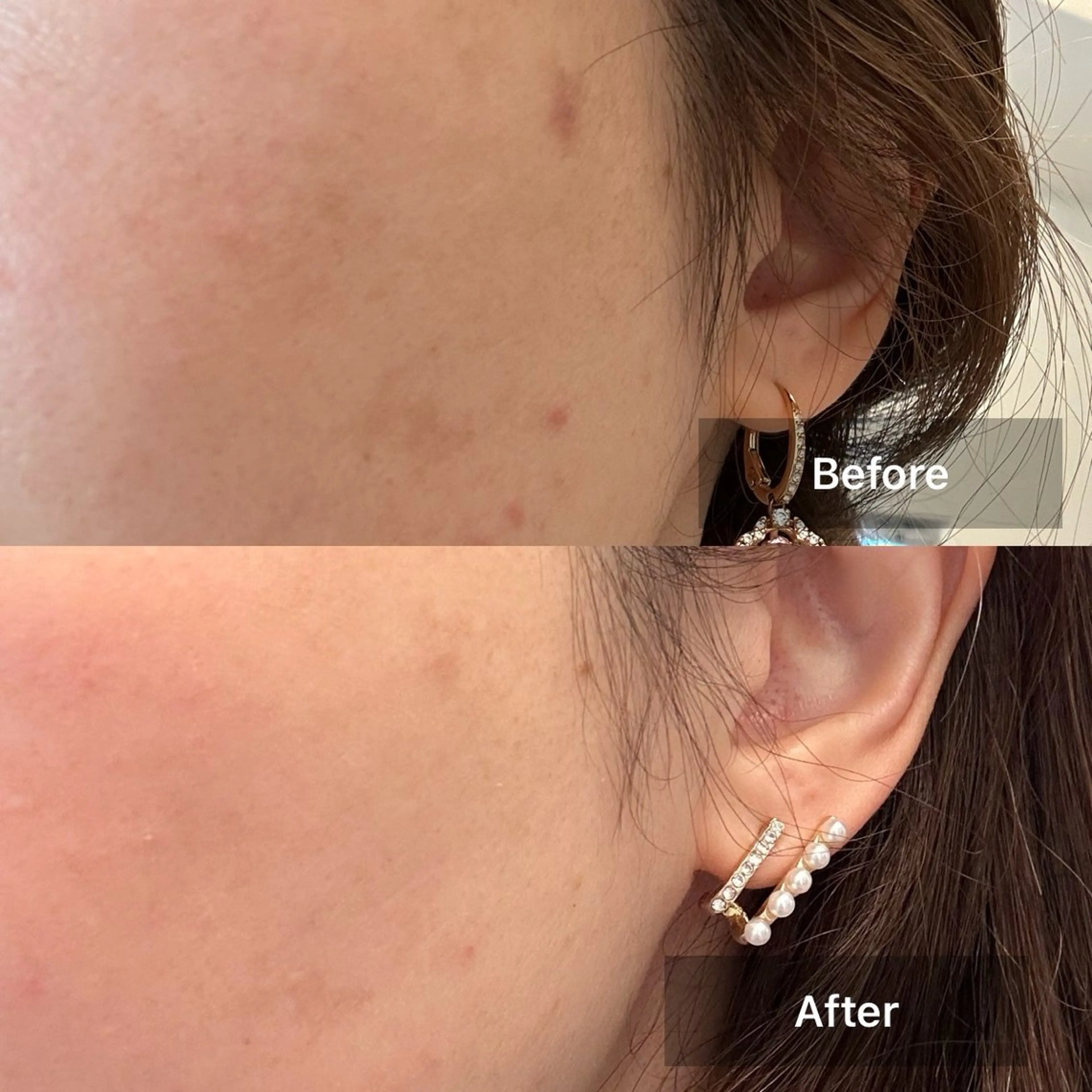 エステ 目元・まつパ・美肌フ ェイシャル谷町四丁目のマツエク・マツパデザイン