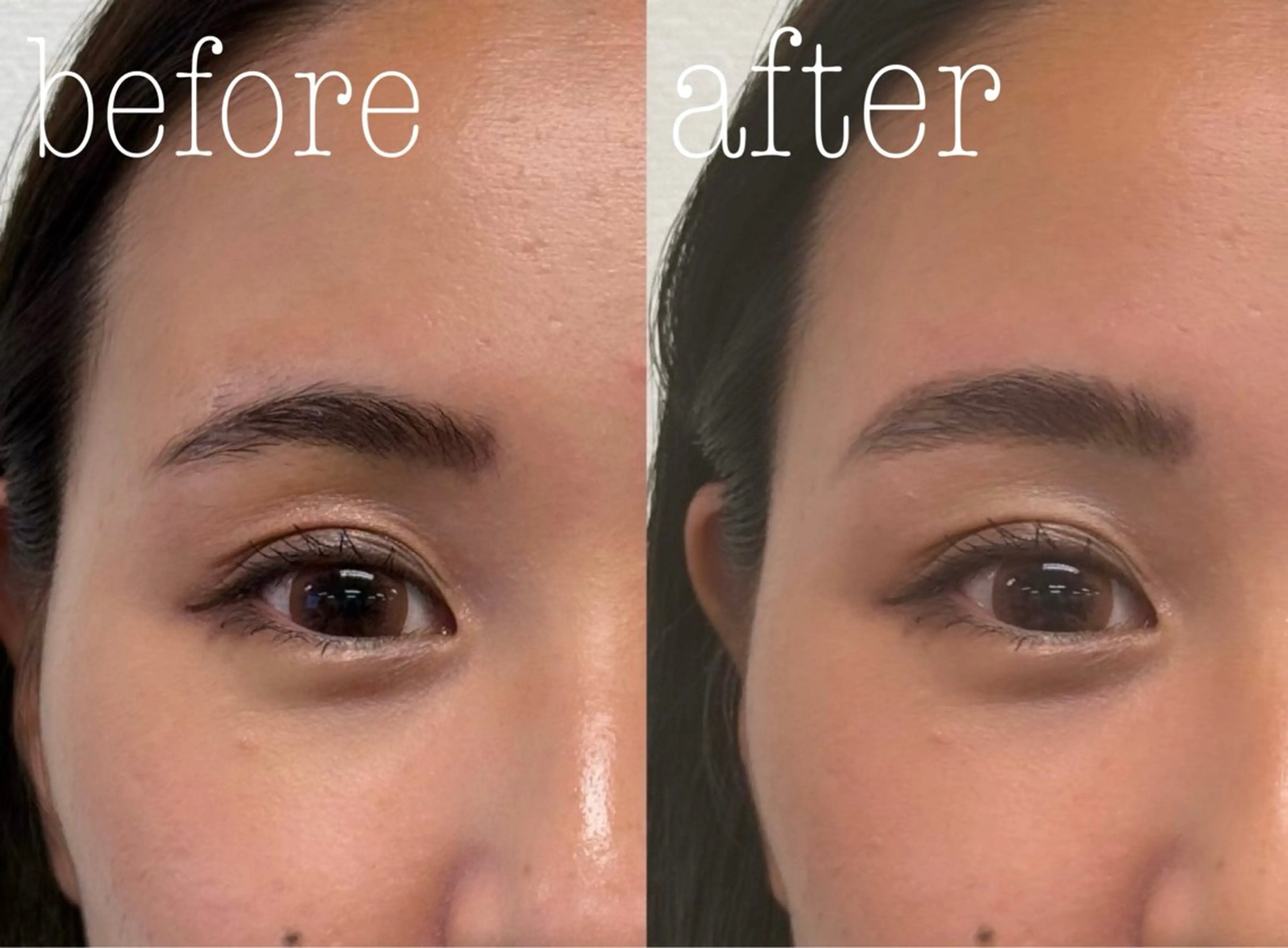 アイブロウ 肌質改善|美眉サロン Cannone’のエステ・リラクイメージ