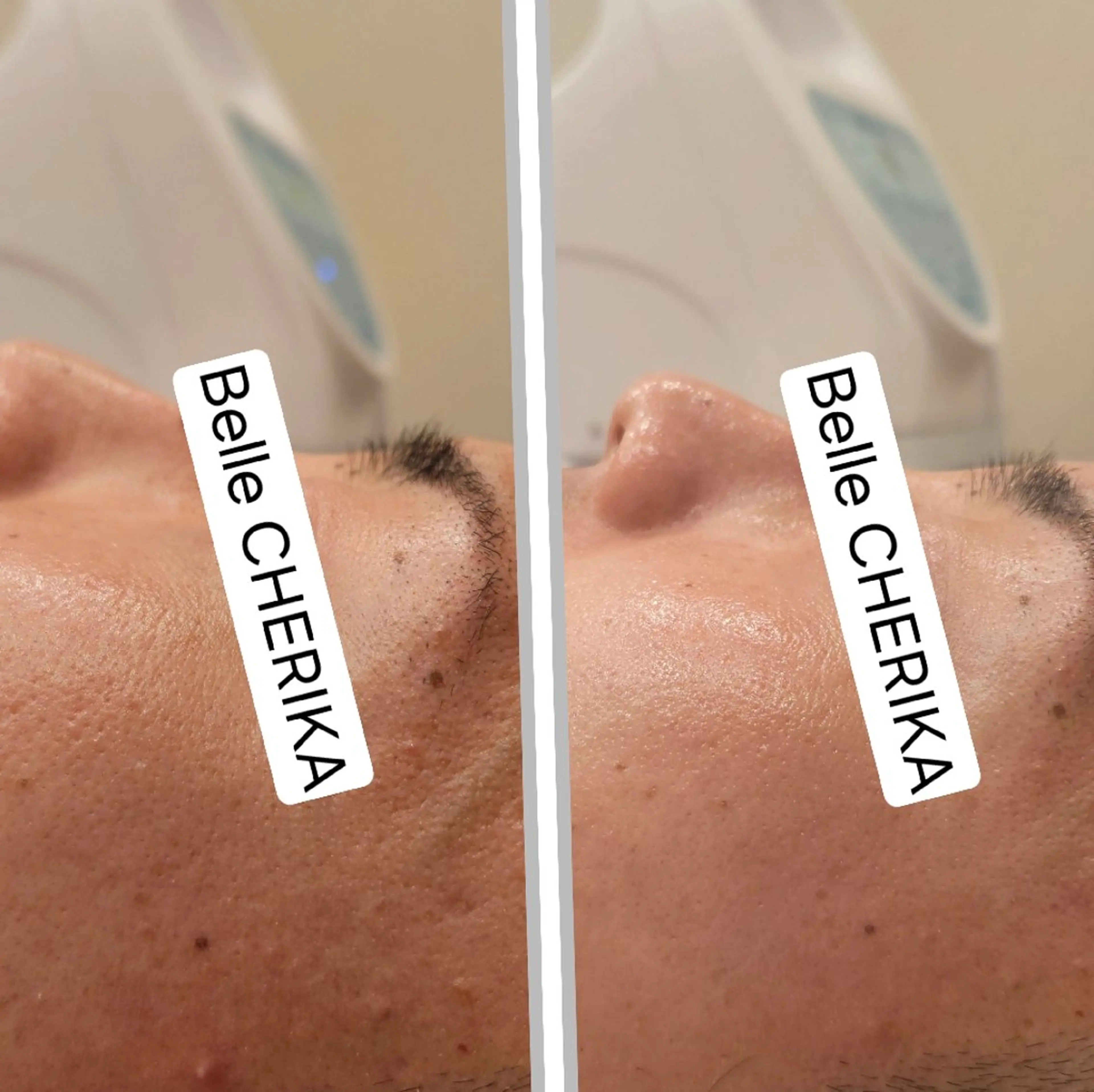 エステ ベル チェリカ 三城のエステ・リラクイメージ