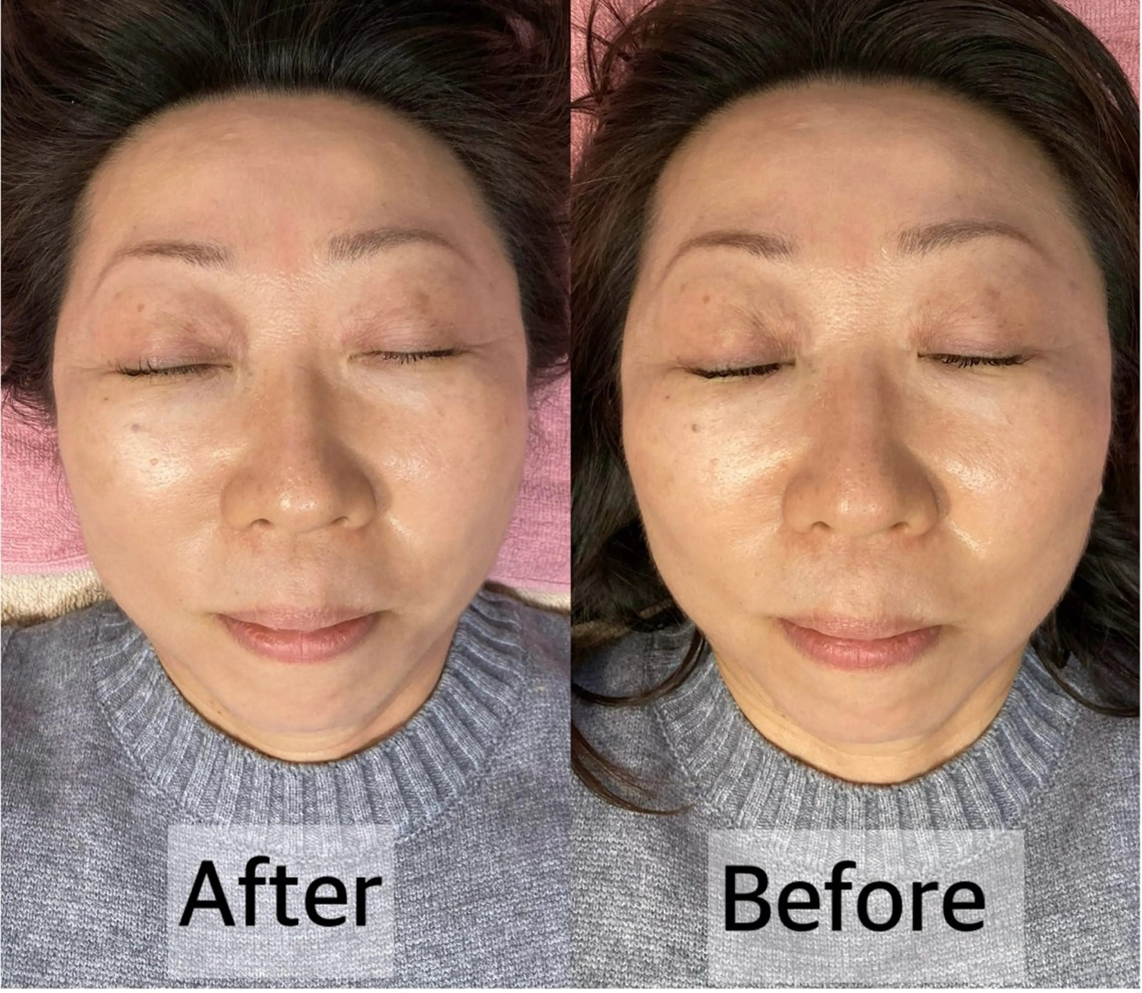 リラク TKサロン所属・TKサロン 柿沼のエステ・リラクイメージ