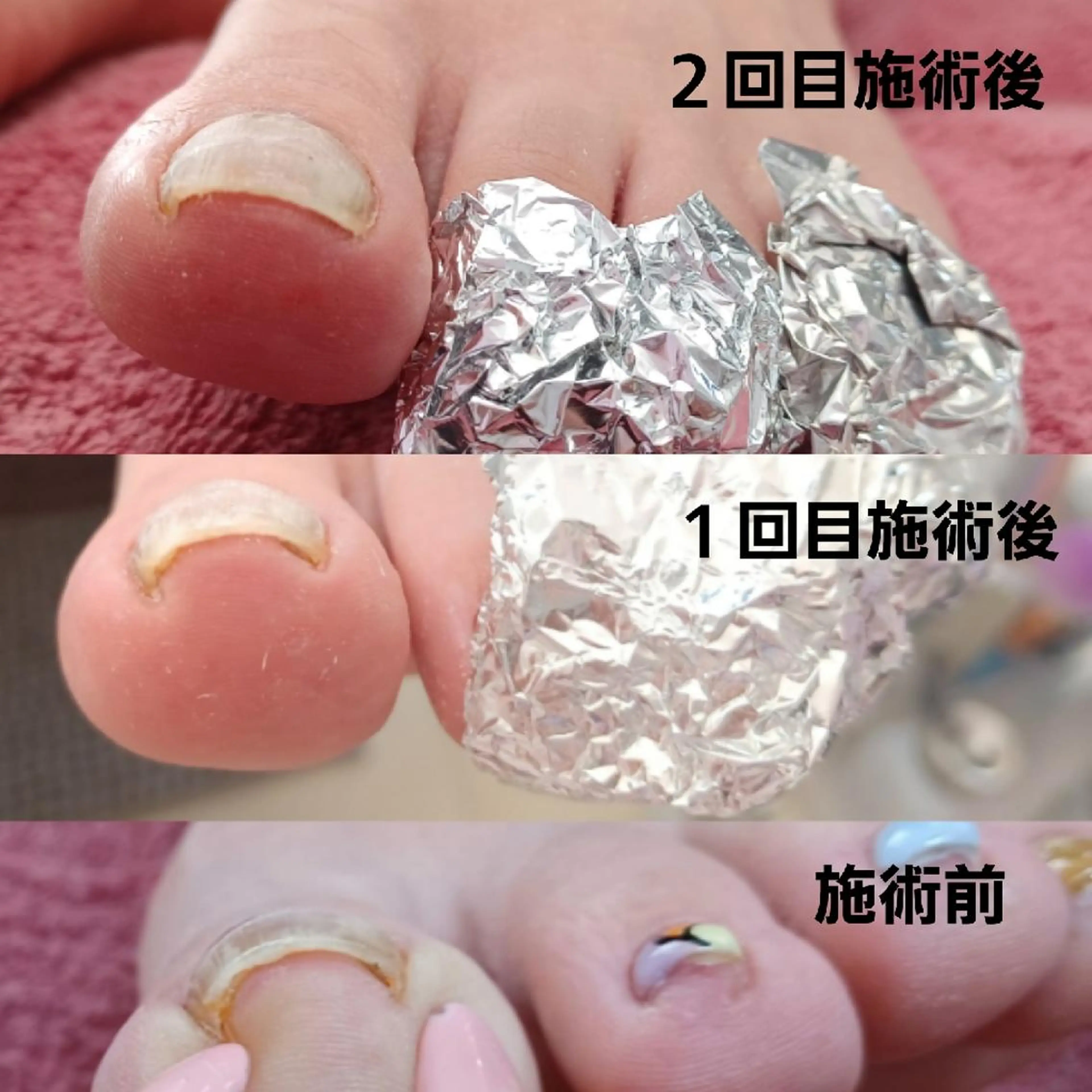 ネイル Micky nail chikushinoのその他イメージ