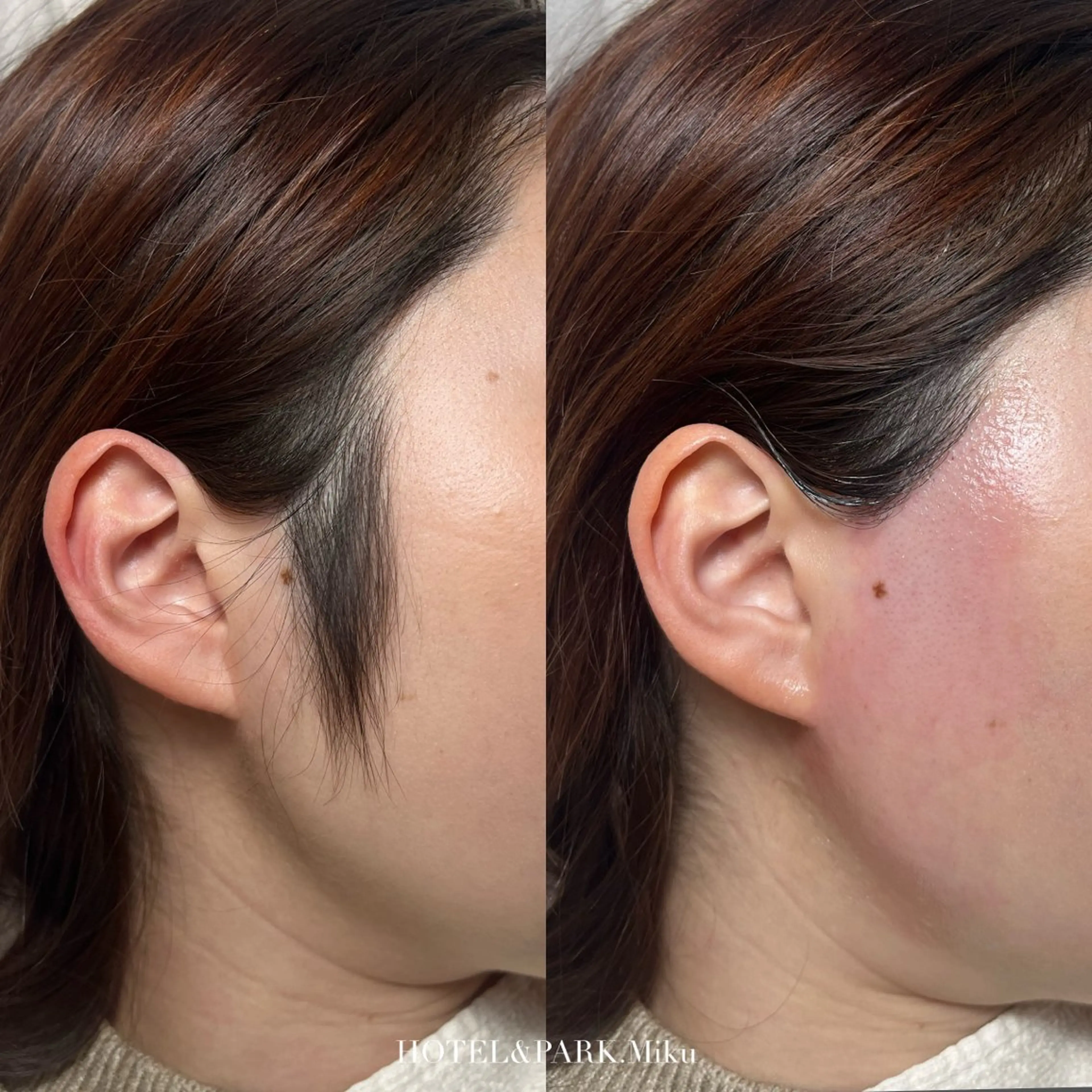 脱毛 HOTEL&PARK Mikuワックス脱毛のエステ・リラクイメージ